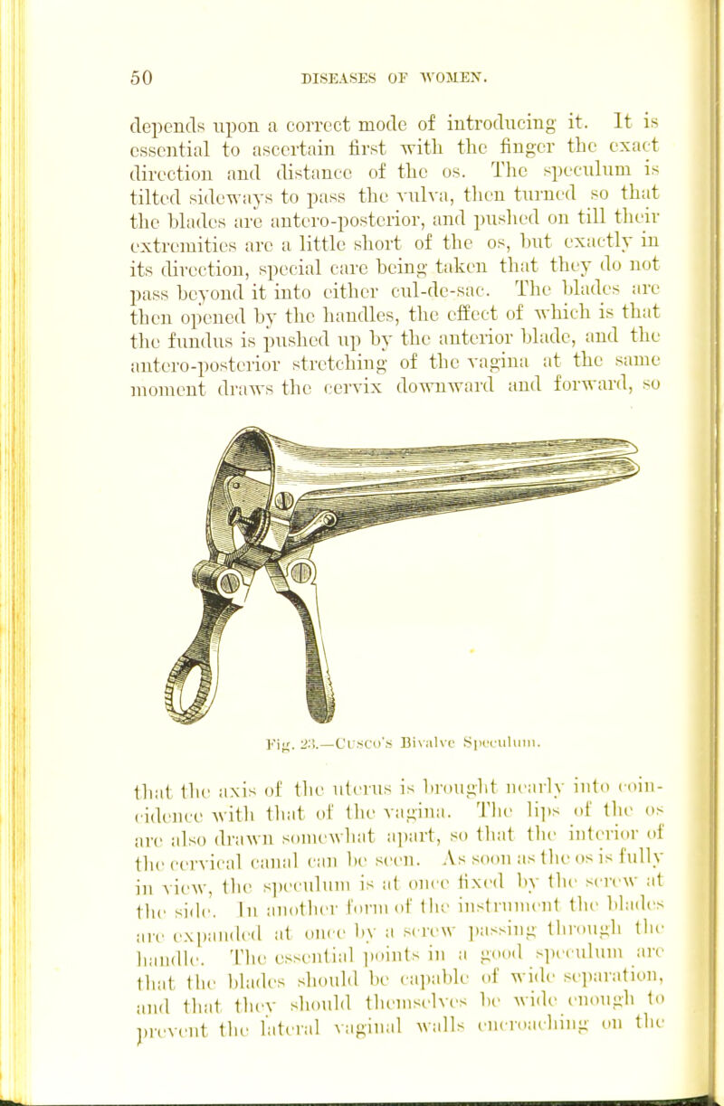 depends upon a correct mode of introducing it. It is essential to ascertain first -^itli the finger the exact direction and distance of the os. The speculum is tilted sideways to pass the vulva, then turned so that the blades are autero-posterior, and pushed on till their extremities are a little short of the os, but exactly in its direction, special care being taken that they do not pass beyond it into either cul-de-sac. The blades arc then opened by the handles, the effect of which is that the fundus is pushed up by the anterior blade, and the antero-postcrior stretching of the vagina at the same moment draws the cervix downward and forward, so J.'iir. 2:'). — Ci sco's Bixiilvi.' S|K'rliluiii. that the axis of the uterus is bnuiglit nearly into eoin- cidence with that of the vagina. The lii)s of the os are also drawn somewhat apart, so that the interior of tlie cervical canal ciin be .seen. As soon as the os is fully in view, the si)eculum is at once tixed hy the srrew at the side. In another foi'm of the instrnnient tlie blades are expanch'd at once by a screw i)asNing through the handle. The essential points in a good speculum are that the blades should be capable of wide separation, and that thev should themselves be wide enough to i)revent the lateral vaginal walls encroaching on the