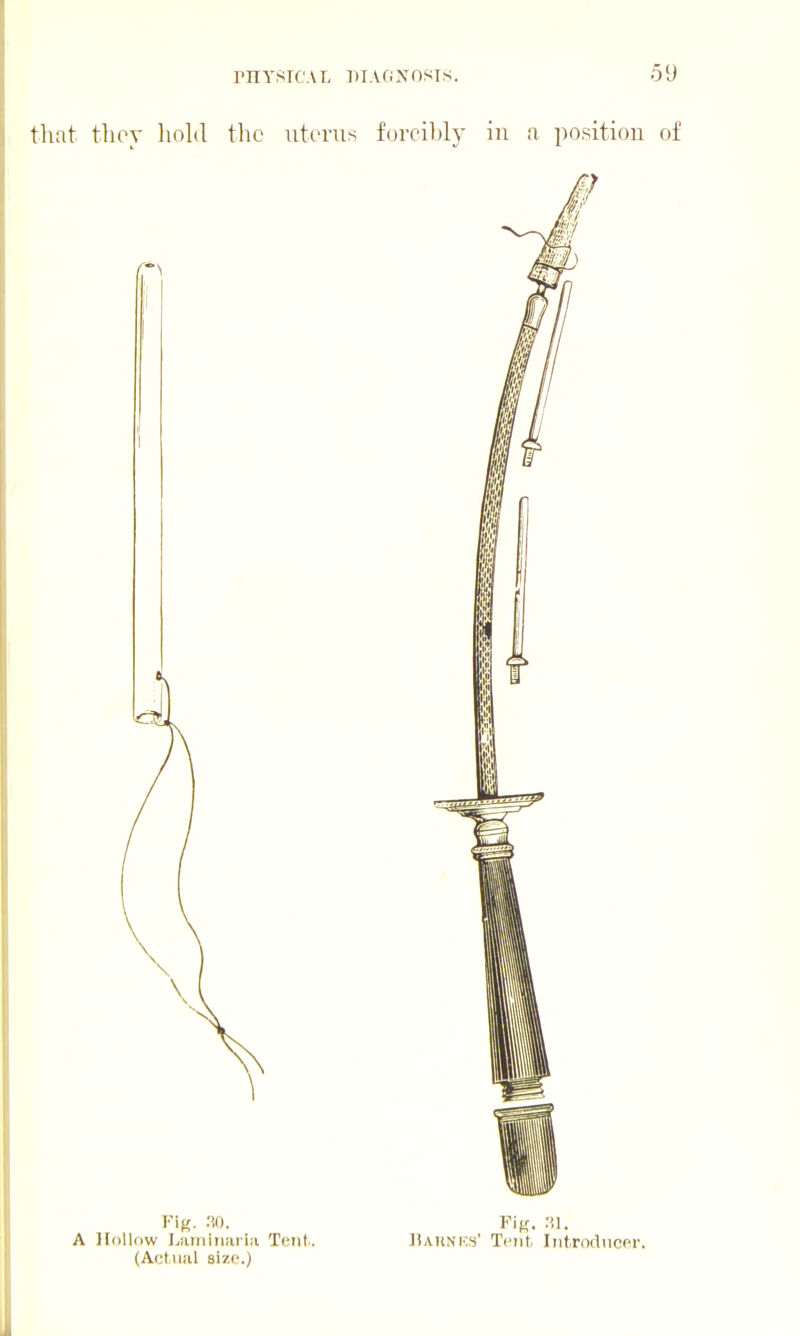 that tlioy liold PnYSrCAL PTAGX0ST8. tlic uterus forcibly in a position A Hollow I,iiiniiiaiia Tent.. (Act.Hill size.) ]lAHNics' Tent Iiitroducpr.