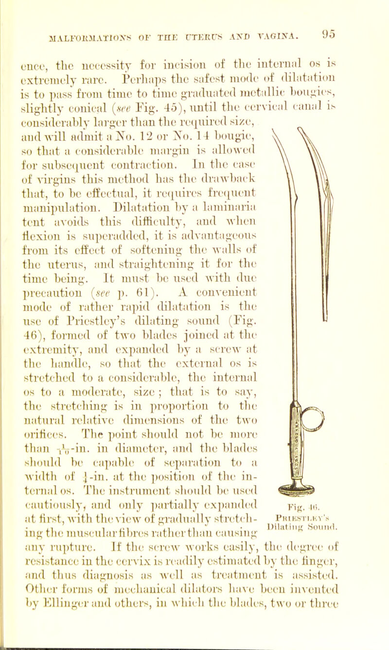 MALFOKM.Vl'lOXS OF TUF TTKltCrS A'SD VAGINA. once, the necessity for incision of the interniil os is extremely rare. Perhaps the safest mode of dilatation is to ptiss from time to time gradnated juotallic houiiies, slightly conical {.see Fig. 45), until the cervical canal is cousiderahly larger than the required si/e, and will admit a ^^o. 12 or l^o. 14 hougie, so that a considerable margin is allowed for snbse(]ucnt contraction. In the case of -s-irgins this method has the drawback that, to be elfectnal, it requires fre(|ueut manipulation. Dilatation by a laminaria tent a^•oids this difficulty, and Avlieu flexion is superadded, it is advantageous from its effect of softening the walls of the uterus, and straightening it for the time being. It must be used Avith due precaution {sec p. 61). A convenient mode of rather rapid dilatation is the use of Priestley's dilating sound (Fig. 46), formed of two blades joined at the extremity, and expanded by a screw at the handle, so that the external os is stretched to a considerable, the internal OS to a moderate, size ; that is to say, the sti'etching is in proportion to the natural relative dimensions of the two orifices. The point should not be more than iTT-in. in diameter, and the blades sliould be capable of separation to a width of ]-in. at the position of the in- ternal OS. The instrument sliouhl be used cautiously, and only ])artially expanded y\„, k;. at first, Avith thcA-iew of gradually stretch- Phiicsti.kv's mg the muscular fibres ratherthan causing any rupture. If the scrcAV Avorks easily, the degree of resistance in the cerA'ix is readily estimated by the finger, and thus diagnosis as Avndl as treatment is assisted. Otiicr forms of mechanical dilators have been invented by Elliugcr and others, in Avhich the blades, two or three