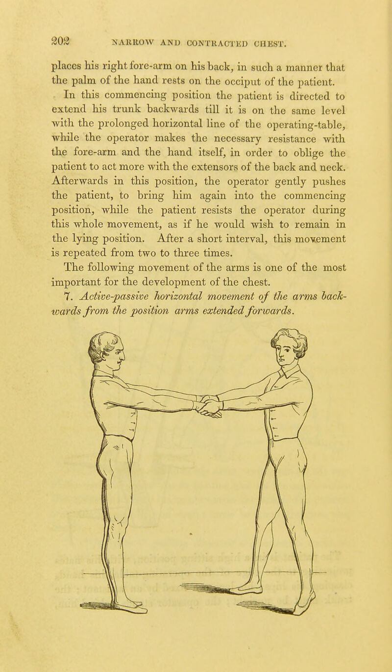 203 places his right fore-arm on his back, in such a manner that the palm of the hand rests on the occiput of the patient. In this commencing position the patient is directed to extend his trunk backwards till it is on the same level with the prolonged horizontal line of the operating-table, while the operator makes the necessary resistance with the fore-arm and the hand itself, in order to oblige the patient to act more with the extensors of the back and neck. Afterwards in this position, the operator gently pushes the patient, to bring him again into the commencing position, while the patient resists the operator during this whole movement, as if he would wish to remain in the lying position. After a short interval, this movement is repeated from two to three times. The following movement of the arms is one of the most important for the development of the chest. 7. Active-passive horizontal movement of the arms hack- xoards from the position arms extended forwards.