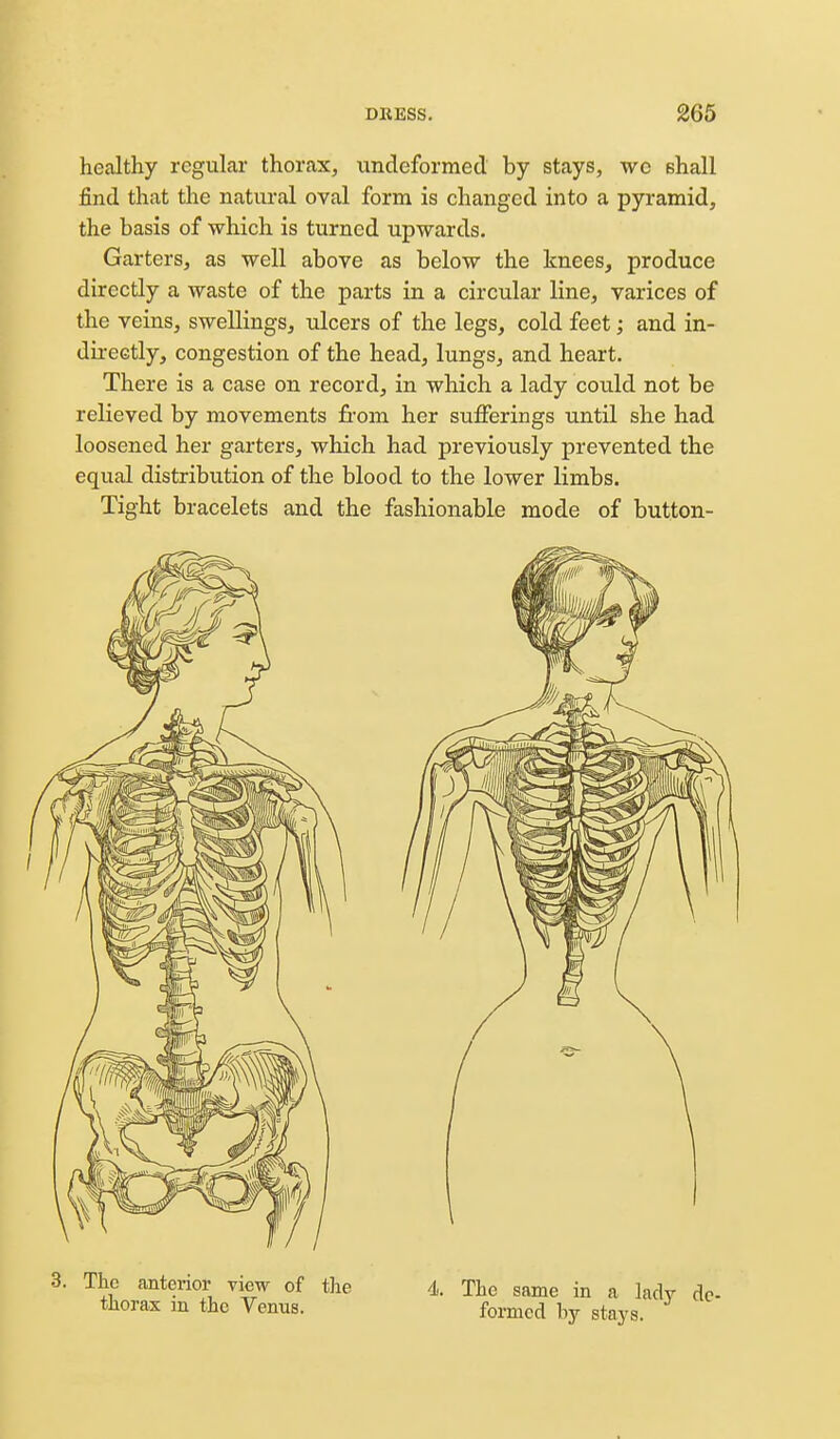 healthy regular thorax, undeformed by stays, wo shall find that the natural oval form is changed into a pyramid, the basis of which is turned upwards. Garters, as well above as below the knees, produce directly a waste of the parts in a circular line, varices of the veins, swellings, ulcers of the legs, cold feet; and in- directly, congestion of the head, lungs, and heart. There is a case on record, in which a lady could not be relieved by movements from her sufferings until she had loosened her garters, which had previously prevented the equal distribution of the blood to the lower limbs. Tight bracelets and the fashionable mode of button- 3. The anterior view of the thorax in the Venus. di. The same in a lady de- formed by stays.