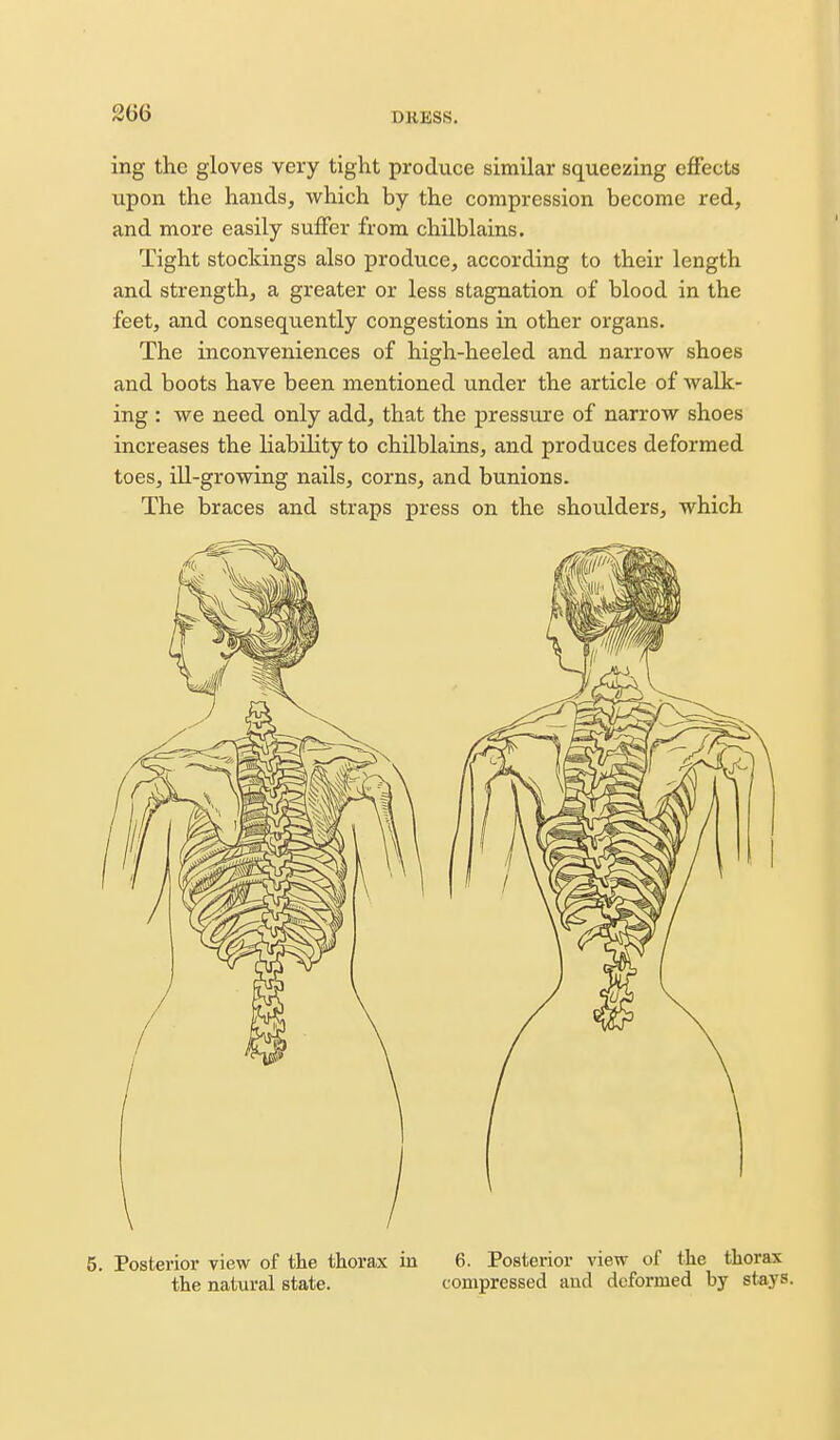 ing the gloves very tight produce similar squeezing efiects upon the hands, which by the compression become red, and more easily suffer from chilblains. Tight stockings also produce, according to their length and strength, a greater or less stagnation of blood in the feet, and consequently congestions in other organs. The inconveniences of high-heeled and narrow shoes and boots have been mentioned under the article of walk- ing : we need only add, that the pressixre of narrow shoes increases the liabiHty to chilblains, and produces deformed toes, ill-growing nails, corns, and bunions. The braces and straps press on the shoulders, which 5. Posterior view of the thorax in 6. Posterior view of the thorax the natural state. compressed and deformed by stays.