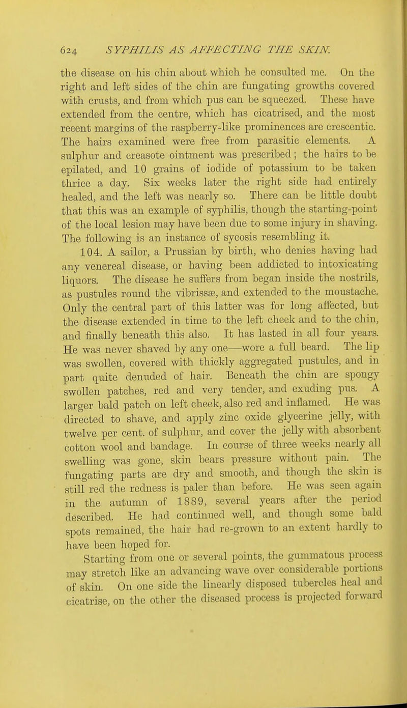the disease on his chin about which he consulted me. On the right and left sides of the chin are fungating growths covered with crusts, and from which pus can be squeezed. These have extended from the centre, which has cicatrised, and the most recent margins of the raspberry-like prominences are crescentic. The hairs examined were free from parasitic elements. A sulphm- and creasote ointment was prescribed; the hairs to be epilated, and 10 grains of iodide of potassium to be taken thrice a day. Six weeks later the right side had entirely healed, and the left was nearly so. There can be little doubt that this was an example of syphilis, though the starting-point of the local lesion may have been due to some injm-y in shaving. The following is an instance of sycosis resembling it. 104. A sailor, a Prussian by birth, who denies having had any venereal disease, or having been addicted to intoxicating liquors. The disease he suffers from began inside the nostrils, as pustules round the vibrissas, and extended to the moustache. Only the central part of this latter was for long affected, but the disease extended in time to the left cheek and to the chin, and finally beneath this also. It has lasted in all four years. He was never shaved by any one—wore a full beard. The lip was swollen, covered with thickly aggregated pustules, and in part quite denuded of hair. Beneath the chin are spongy swollen patches, red and very tender, and exuding pus. A larger bald patch on left cheek, also red and inflamed. He was directed to shave, and apply zinc oxide glycerine jelly, with twelve per cent, of sulphur, and cover the jelly with absorbent cotton wool and bandage. In course of three weeks nearly all swelling was gone, skin bears pressiu^e without pain. The fimgating parts are dry and smooth, and though the skin is still red the redness is paler than before. He was seen again in the autumn of 1889, several years after the period described. He had continued well, and though some bald spots remained, the hair had re-grown to an extent hardly to have been hoped for. Starting from one or several points, the gummatous process may stretch like an advancing wave over considerable portions of skin. On one side the linearly disposed tubercles heal and cicatrise, on the other the diseased process is projected forward