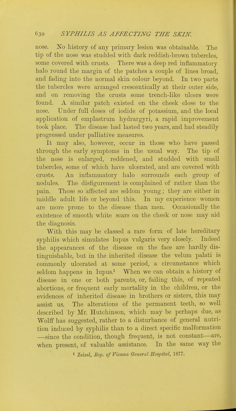 nose. No history of any primary lesion was obtainable. The tip of the nose was studded with dark reddish-brown tubercles, some covered with crusts. There was a deep red inflammatory halo round the margin of the patches a couple of lines broad, and fading into the normal skin colour beyond. In two parts the tubercles were arranged crescentically at their outer side, and on removing the crusts some trench-like ulcers were found. A similar patch existed on the cheek close to the nose. Under full doses of iodide of potassium, and the local application of emplastrum hydrargyri, a rapid improvement took place. The disease had lasted two years, and had steadily progressed under palliative measures. It may also, however, occur in those who have passed through the early symptoms in the usual way. The tip of the nose is enlarged, reddened, and studded with small tubercles, some of which have ulcerated, and are covered with crusts. An inflammatory halo surrounds each group of nodules. The disfigurement is complained of rather than the pain. Those so affected are seldom young; they are either in middle adult life or beyond this. In my experience women are more prone to the disease than men. Occasionally the existence of smooth white scars on the cheek or nose may aid the diagnosis. With this may be classed a rare form of late hereditary syphilis which simulates lupus vulgaris very closely. Indeed the appearances of the disease on the face are hardly dis- tinguishable, but in the inherited disease the velum palati is commonly ulcerated at some period, a circumstance which seldom happens in lupus.^ When we can obtain a history of disease in one or both parents, or, failing this, of repeated abortions, or frequent early mortality in the children, or the evidences of inherited disease in brothers or sisters, this may assist us. The alterations of the permanent teeth, so well described by Mr. Hutchinson, which may be perhaps due, as Wolff has suggested, rather to a disturbance of general nutri- tion induced by syphilis than to a direct specific malformation —since the condition, though frequent, is not constant—are, when present, of valuable assistance. In the same way the ^ Zeissl, iJcp. of Vienna General Hospital, 1877.