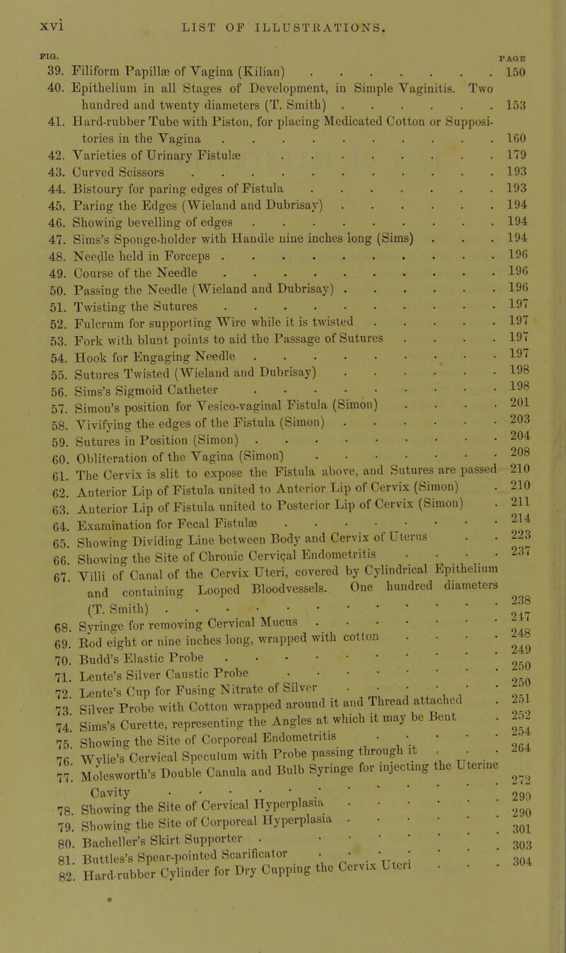 Two FIG. 39. Filiform Papillae of Vagina (Kilian) 40. Epithelium in all Stages of Development, in Simple Vaginitis. hundred and twenty diameters (T. Smith) 41. Hard-rubber Tube with Piston, for placing Medicated Cotton or Supposi- tories in the Vagina 42. Varieties of Urinary Fistulas 43. Curved Scissors 44. Bistoury for paring edges of Fistula 45. Paring the Edges (Wieland and Dubrisay) PAGE 1.50 153 IGO 179 193 193 194 46. 47. 48. 49. 50. 51. 52. 53. 54. 55. 56. 57. 58. 59. 60. 61. 62. 63. 64. 65 Showing bevelling of edges 194 Sims's Sponge-holder with Handle nine inches long (Sims) . . . 194 Neefile held in Forceps 196 Course of the Needle 196 Passing the Needle (Wieland and Dubrisay) 196 Twisting the Sutures 197 Fulcrum for supporting Wire while it is twisted Fork with blunt points to aid the Passage of Sutures .... Hook for Engaging Needle Sutures Twisted (Wieland and Dubrisay) Sims's Sigmoid Catheter . . • • Simon's position for Vesico-vaginal Fistula (Simon) .... Vivifying the edges of the Fistula (Simon) Sutures in Position (Simon) Obliteration of the Vagina (Simon) The Cervix is slit to expose the Fistula above, and Sutures are passed Anterior Lip of Fistula united to Anterior Lip of Cervix (Simon) Anterior Lip of Fistula united to Posterior Lip of Cervix (Simon) Examination for Fecal Fistnloe . • • • • Showing Dividing Line between Body and Cervix of Uterus 66 Showing the Site of Chronic CerviQal Endometritis .... 67 Villi of Canal of the Cervix Uteri, covered by Cylindrical Epithelium and containing Looped Bloodvessels. One hundred diameters (T. Smith) Syringe for removing Cervical Mucus . Eod eight or nine inches long, wrapped with cotton Budd's Elastic Probe Lente's Silver Caustic Probe • • • • Lente's Cup for Fusing Nitrate of Silver . • , ^ _ , Silver Probe with Cotton wrapped around it and Thread attached Sims's Curette, representing the Angles at which it may be Bent Showing the Site of Corporeal Endometritis • • Wvlie's Cervical Speculum with Probe passing through It 77; Moksworth's Double Canula and Bulb Syringe for injecting the Uterme Cavity Showing the Site of Cervical Hyperplasia Showing the Site of Corporeal Hyperplasia Bacheller's Skirt Supporter . Buttles's Spear-pointed Scarificator . Hard-rubber Cylinder for Dry Cupping the Cervix Utcii 68. 69. 70. 71. 72. 73. 74. 75. 76 78. 79. 80. 81. 82. 197 197 197 198 198 201 203 204 208 210 210 211 214 223 237 238 2i7 248 249 250 2.50 251 252 254 264 272 290 290 301 303 304