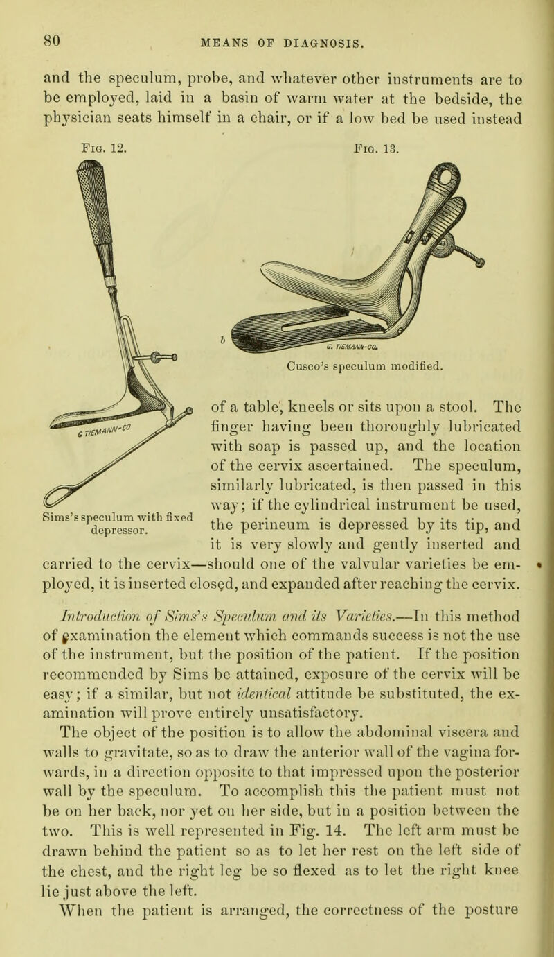 and the speculum, probe, and whatever other instruments are to be employed, laid in a basin of warm water at the bedside, the physician seats himself in a chair, or if a low bed be used instead Fig. 12. Fig. 13. Sims's speculum with fixed depressor. Cusco's speculum modified. of a table, kneels or sits upon a stool. The finger having been thoroughly lubricated with soap is passed up, and the location of the cervix ascertained. The speculum, similarly lubricated, is then passed in this way; if the cylindrical instrument be used, the perineum is depressed by its tip, and it is very slowly aud gently inserted and carried to the cervix—should one of the valvular varieties be em- ployed, it is inserted closed, and expanded after reaching the cervix. Introduction of Sims''s Speculum and its Varieties.—In this method of examination the element which commands success is not the use of the instrument, but the position of the patient. If the position recommended by Sims be attained, exposure of the cervix will be easy; if a similar, but not identical attitude be substituted, the ex- amination will prove entirely unsatisfactory. The object of the position is to allow the abdominal viscera and walls to gravitate, so as to draw the anterior wall of the vagina for- wards, in a direction opposite to that impressed upon the posterior wall by the speculum. To accomplish this the patient must not be on her back, nor yet on her side, but in a position between the two. This is well represented in Fig. 14. The left arm must be drawn behind the patient so as to let her rest on the left side of the chest, and the right leg be so flexed as to let the right knee lie just above the left. When the patient is arranged, the correctness of the posture