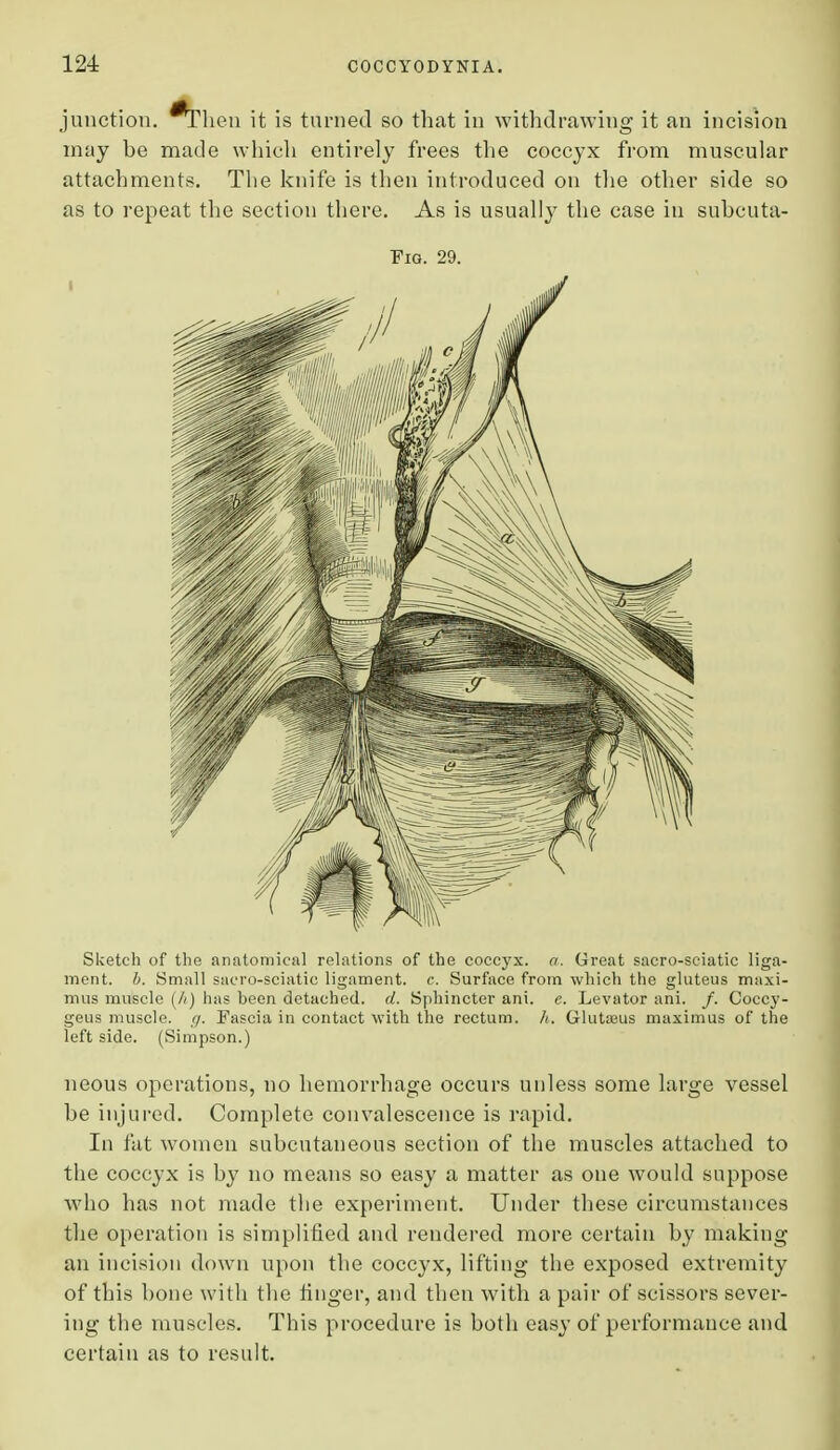 junction. ^Then it is turned so that in withdrawing it an incision may be made which entirely frees the coccyx from muscular attachments. The knife is then introduced on the other side so as to repeat the section there. As is usually the case in subcuta- Fig. 29. Sketch of the anatomical relations of the coccyx, a. Great sacro-sciatic liga- ment, b. Small sacro-sciatic ligament, c. Surface from which the gluteus maxi- mus muscle (h) has heen detached, d. Sphincter ani. e. Levator ani. /. Coecy- geus muscle, g. Fascia in contact with the rectum, h. Gluteus maxim us of the left side. (Simpson.) neous operations, no hemorrhage occurs unless some large vessel be injured. Complete convalescence is rapid. In fat women subcutaneous section of the muscles attached to the coccyx is by no means so easy a matter as one would suppose who has not made the experiment. Under these circumstances the operation is simplified and rendered more certain by making an incision down upon the coccyx, lifting the exposed extremity of this hone with the finger, and then with a pair of scissors sever- ing the muscles. This procedure is both easy of performance and certain as to result.