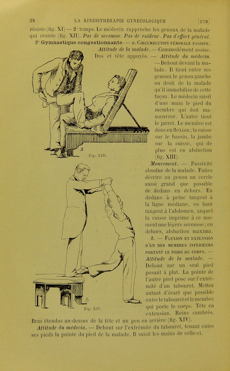 résiste(fig. XI) — 21 temps. Le médecin rapproche les genoux de La malade qui résiste (flg. XII). Pas de secousse. Pas de roideur. Pas d'effort général. 2° Gymnastique congestionnante. — a. GlRCUMDOCTlON FÉMORALE PASSIVE. Attitude de la malade. — Commodémenl assise. Dos el tête appuyés. — Attitude du médecin. — Debout devant la ma- lade . Il tient entre ses genoux le genou gauche ou droit de la malade qu'il immobilise de celle façon. Le médecin saisit d'une main le pied du membre qui doit ma- nœuvrer. L'autre lient le jarret. Le membre est doncen llexion ; la cuisse sur le bassin, la jambe sur la cuisse, qui de plus est en abduction (flg. XIII). Mouvement. — Passivité absolue de la malade. Faites décrire au genou un cercle aussi grand que possible de dedans en dehors. En dedans à peine langent à la ligne médiane, en haut langent à l'abdomen, auquel la cuisse imprime à ce mo- ment une légère secousse ; en dehors, abduction maxima. b. — Flexion et extension d'un des membres inférieurs portant le poids du corps. — Attitude de la malade. — Debout sur un seul pied posant à plal. La pointe de l'autre pied pose suri'extré- mité d'un tabouret. Mettez aidant d'écart que possible entreletabourètet le membre qui porte le corps. Tète en extension. Reins cambrés. Bras étendus au-dessus de la tête el un peu en arrière (flg. XIV). Attitude du médecin. — Debout sur l'extrémité du tabouret, tenant entre ses pieds la pointe du pied tic la malade. Il saisil les mains de celle-ci.