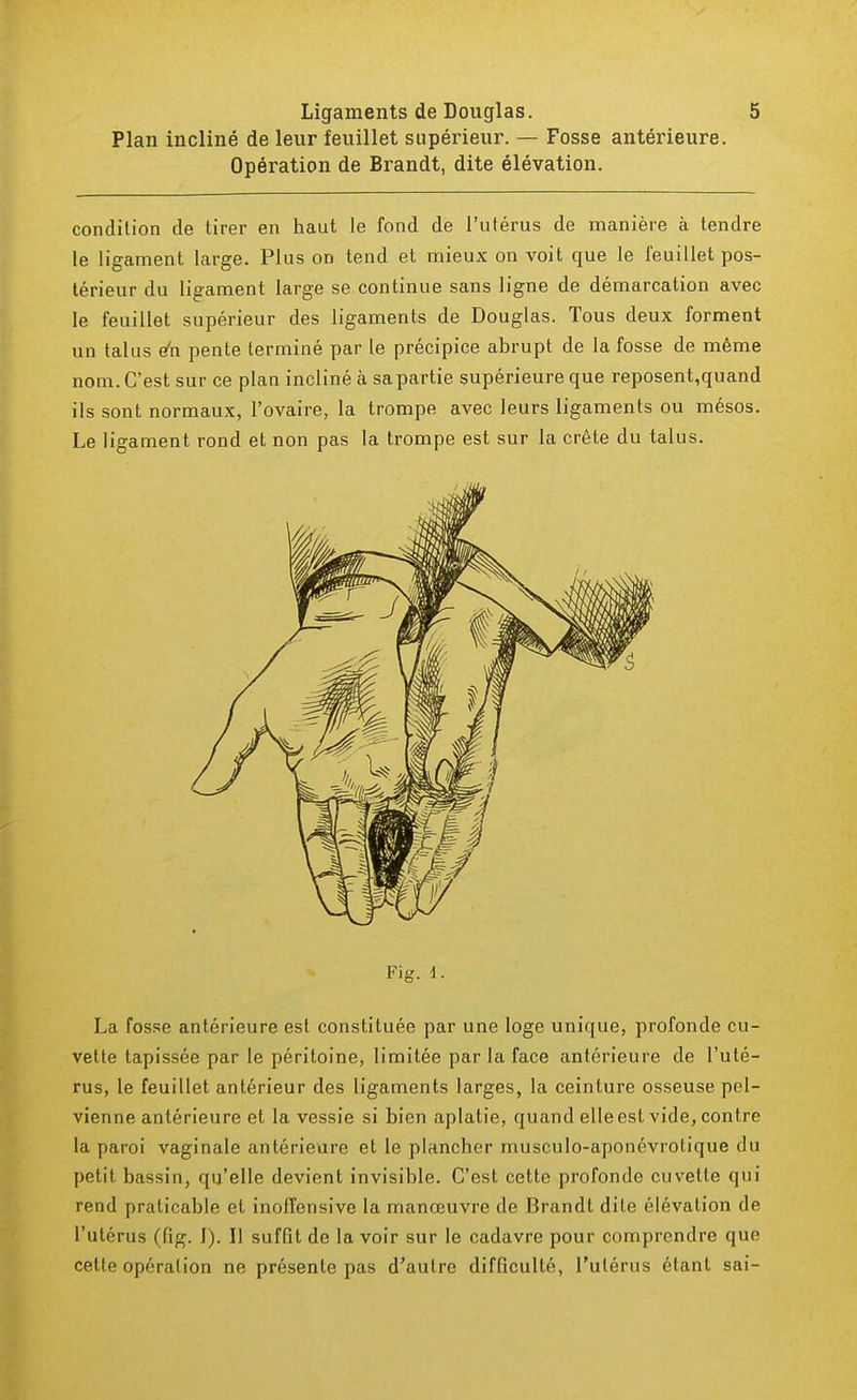 Plan incliné de leur feuillet supérieur. — Fosse antérieure. Opération de Brandt, dite élévation. condition de tirer en haut le fond de l'utérus de manière à tendre le ligament large. Plus on tend et mieux on voit que le feuillet pos- térieur du ligament large se continue sans ligne de démarcation avec le feuillet supérieur des ligaments de Douglas. Tous deux forment un talus en pente terminé par le précipice abrupt de la fosse de même nom. C'est sur ce plan incliné à sa partie supérieure que reposent,quand ils sont normaux, l'ovaire, la trompe avec leurs ligaments ou mésos. Le ligament rond et non pas la trompe est sur la crête du talus. Fig. 4. La fosse antérieure est constituée par une loge unique, profonde cu- vette tapissée par le péritoine, limitée par la face antérieure de l'uté- rus, le feuillet antérieur des ligaments larges, la ceinture osseuse pel- vienne antérieure et la vessie si bien aplatie, quand elle est vide, contre la paroi vaginale antérieure et le plancher rnusculo-aponévrotique du petit bassin, qu'elle devient invisible. C'est cette profonde cuvette qui rend praticable et inoffensive la manœuvre de Brandt dite élévation de l'utérus (fig. 1). Il suffit de la voir sur le cadavre pour comprendre que cette opération ne présente pas d'autre difficulté, l'utérus étant sai-