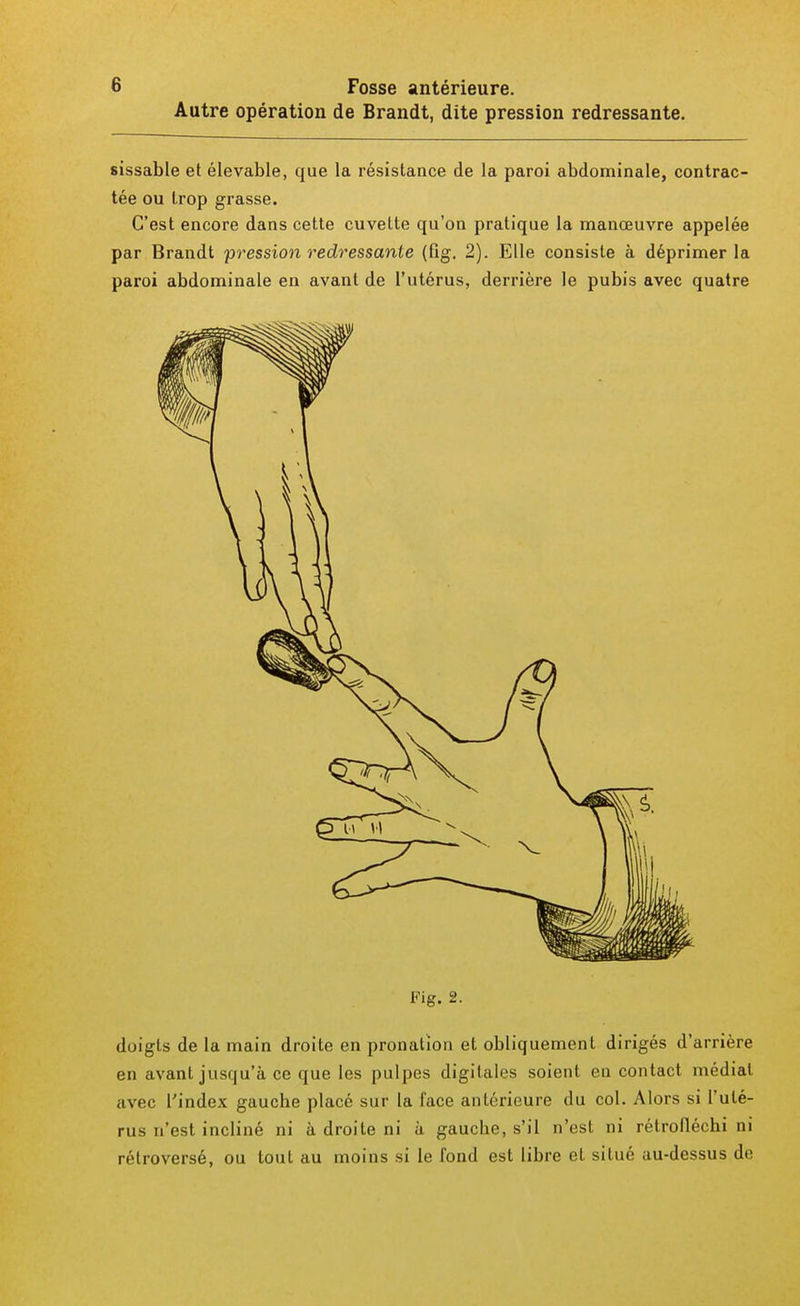 Autre opération de Brandt, dite pression redressante. sissable et élevable, que la résistance de la paroi abdominale, contrac- tée ou trop grasse. C'est encore dans cette cuvette qu'on pratique la manœuvre appelée par Brandt pression redressante (fig. 2). Elle consiste à déprimer la paroi abdominale en avant de l'utérus, derrière le pubis avec quatre Fig. 2. doigts de la main droite en pronatïon et obliquement dirigés d'arrière en avant jusqu'à ce que les pulpes digitales soient en contact médiat avec l'index gauche placé sur la face antérieure du col. Alors si l'uté- rus n'est incliné ni à droite ni à gauche, s'il n'est ni rétrofléchi ni rétroversé, ou tout au moins si le fond est libre et situé au-dessus de