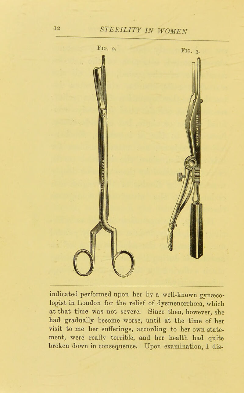 indicated performed upon her by a well-known gynseco- logist in London for the relief of dysmenorrhoea, which at that time was not severe. Since then, however, she had gradually become worse, until at the time of her visit to me her sufferings, according to her own state- ment, were really terrible, and her health had quite