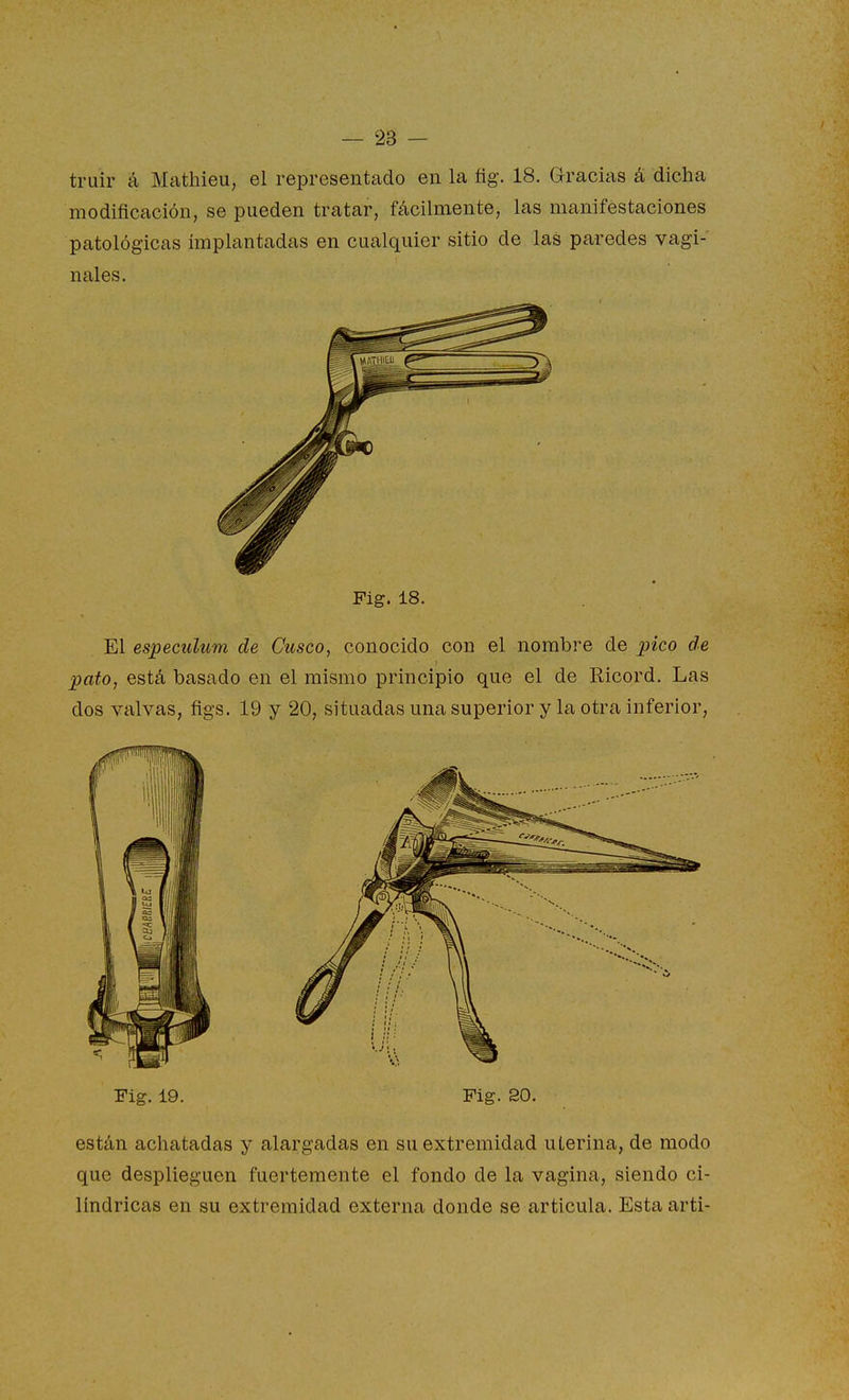 truir á Mathieu, el representado en la fig. 18. Gracias á dicha modificación; se pueden tratar, fácilmente, las manifestaciones patológicas implantadas en cualquier sitio de las paredes vagi- nales. Fig. 18. El especulum de Cusco, conocido con el nombre de pico de pato, está basado en el mismo principio que el de Ricord. Las dos valvas, figs. 19 y 20, situadas una superior y la otra inferior. Fig. 19. Fig. 20. están achatadas y alargadas en su extremidad uterina, de modo que desplieguen fuertemente el fondo de la vagina, siendo ci- lindricas en su extremidad externa donde se articula. Esta arti-