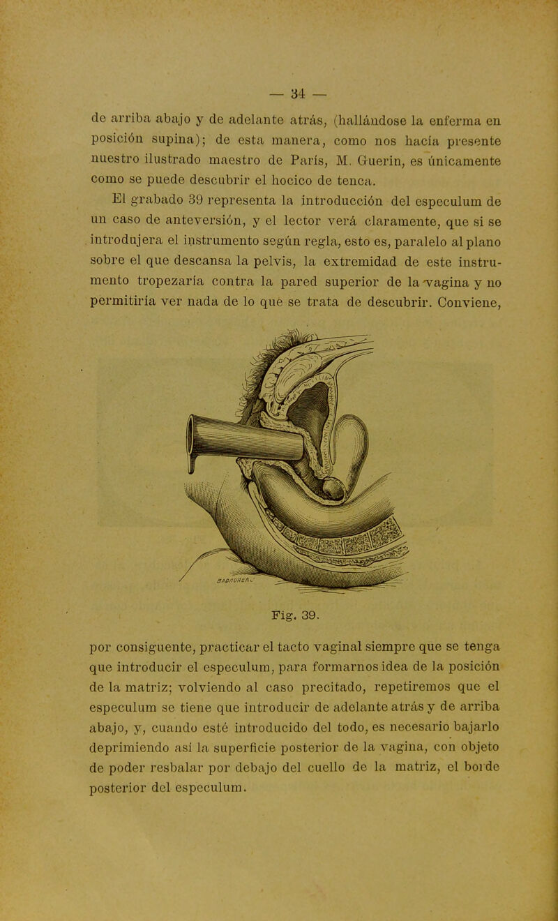 de arriba abajo y de adelante atrás, (hallándose la enferma en posición supina); de esta manera, como nos hacía presente nuestro ilustrado maestro de París, M, Guerin, es únicamente como se puede descubrir el hocico de tenca. El grabado 39 representa la introducción del especulum de un caso de anteversión, y el lector verá claramente, que si se introdujera el instrumento según regla, esto es, paralelo al plano sobre el que descansa la pelvis, la extremidad de este instru- mento tropezaría contra la pared superior de la 'vagina y no permitiría ver nada de lo que se trata de descubrir. Conviene, Fig. 39. por consígnente, practicar el tacto vaginal siempre que se tenga que introducir el especulum, para formarnos idea de la posición de la matriz; volviendo al caso precitado, repetiremos que el especulum se tiene que introducir de adelante atrás y de arriba abajo, y, cuando esté introducido del todo, es necesario bajarlo deprimiendo así la superficie posterior de la vagina, con objeto de poder resbalar por debajo del cuello de la matriz, el borde posterior del especulum.