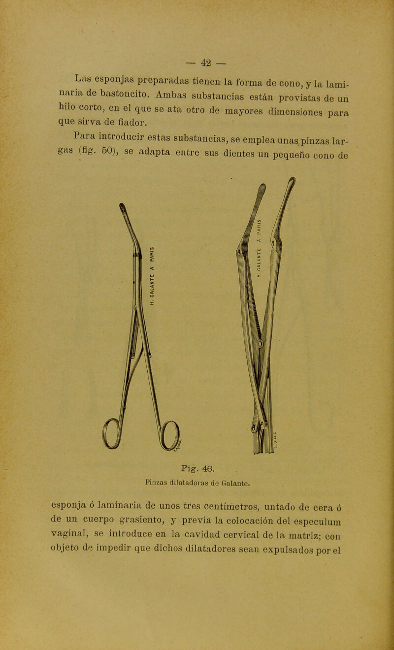 Las esponjas preparadas tienen la forma de cono, y la lami- naria de bastoncito. Ambas substancias están provistas de un hilo corto, en el que se ata otro de mayores dimensiones para que sirva de fiador. Para introducir estas substancias, se emplea unas pinzas lar- gas (fig. 60), se adapta entre sus dientes un pequeño cono de Fig. 46. Pinzas dilatadoras de Galante. esponja ó laminaria de unos tres centímetros, untado de cera ó de un cuerpo grasicnto, y previa la colocación del especulum vaginal, se introduce en la cavidad cervical de la matriz; con objeto de impedir que dichos dilatadores sean expulsados por el