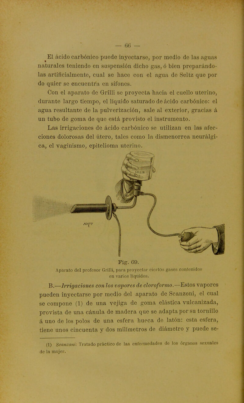 ^El ácido cíirbónico puede inyectarse, por medio de las aguas naturales teniendo en suspensión dicho gas, ó bien preparándo- las artificialmente, cual se hace con el agua de Seltz que por do quier se encuentra en sifones. Con el aparato de Grilli se proyecta hacia el cuello uterino, durante largo tiempo, el líquido saturado de ácido carbónico: el agua resultante de la pulverización, sale al exterior, gracias á un tubo de goma de que está provisto el instrumento. Las irrigaciones de ácido carbónico se utilizan en las afec- ciones dolorosas del útero, tales como la dismenorrea neurálgi- ca, el vaginismo, epitelioma uterino. Fig. 69. Aparato del profesor Grilli, para proyectar ciertos gases conlenidos en varios líquidos. B.—Irrigaciones con los vapores de cloroformo.—Estos vapores pueden inyectarse por medio del aparato de Scanzoni, el cual se compone (1) de una vejiga de goma elástica vulcanizada, provista de una cánula de madera que se adapta por su tornillo á uno de los polos de una esfera hueca de latón: esta esfera, tiene unos cincuenta y dos milímetros de diámetro y puede se- (1) Scanzoni: Tratado práctico de las enfermedades de los órganos sexuales de la mujer.