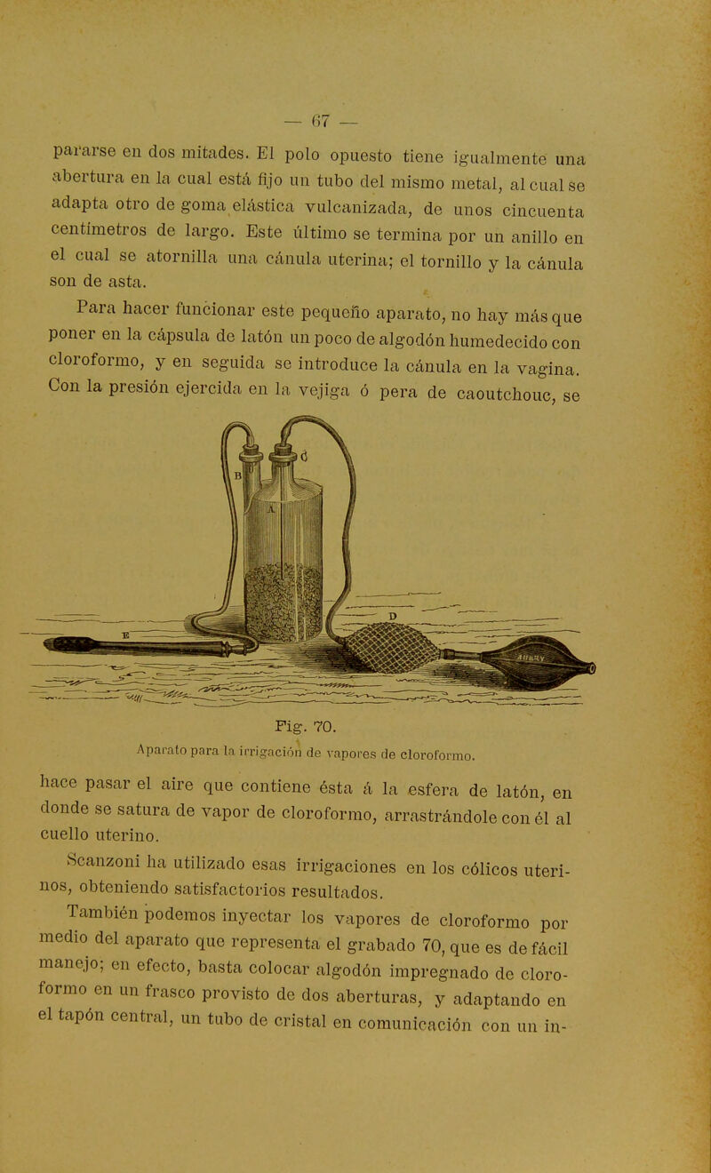 pararse en dos mitades. El polo opuesto tiene igualmente una abertura en la cual estcá fijo un tubo del mismo metal, al cual se adapta otro de goma elástica vulcanizada, de unos cincuenta centímetros de largo. Este último se termina por un anillo en el cual se atornilla una cánula uterina; el tornillo y la cánula son de asta. Para hacer funcionar este pequeño aparato, no hay más que poner en la cápsula de latón un poco de algodón humedecido con cloroformo, y en seguida se introduce la cánula en la vagina. Con la presión ejercida en la vejiga ó pera de caoutchouc, se Pig. 70. Aparato para la irrigación de vapores de cloroformo. hace pasar el aire que contiene ésta á la esfera de latón, en donde se satura de vapor de cloroformo, arrastrándole con él al cuello uterino. Scanzoni ha utilizado esas irrigaciones en los cólicos uteri- nos, obteniendo satisfactorios resultados. También podemos inyectar los vapores de cloroformo por medio del aparato que representa el grabado 70, que es de fácil manejo; en efecto, basta colocar algodón impregnado de cloro- formo en un frasco provisto de dos aberturas, y adaptando en el tapón central, un tubo de cristal en comunicación con un in-