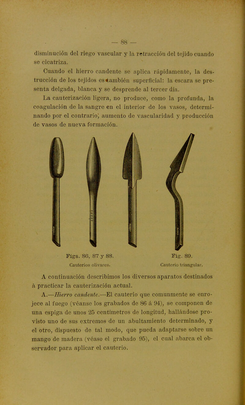 disminución del riego vascular y la retracción del tejido cuando se cicatriza. Cuando el hierro candente se aplica rápidamente, la des- trucción de los tejidos es «también superficial: la escara se pre- senta delgada, blanca y se desprende al tercer día. La cauterización ligera, no produce, como la profunda, la coagulación de la sangre en el interior de los vasos, determi- nando por el contrario) aumento de vascularidad y producción de vasos de nueva formación. Figs. 86, 87 y 88. Fig. 89. Cauterios olivares. Cauterio triangular. A continuación describimos los diversos aparatos destinados k practicar la cauterización actual. A.—Hievro candente.—El cauterio que comunmente se enro- jece al fuego (véanse los grabados de 86 á 94), se componen de una espiga de unos 25 centímetros de longitud, hallándose pro- visto uno de sus extremos de un abultamiento determinado, y el otro, dispuesto de tal modo, que pueda adaptarse sobre un mango de madera (véase el grabado 95), el cual abarca el ob- servador para aplicar el cauterio.