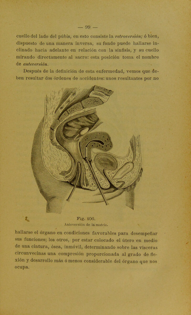 cuello del lado del pubis, en esto consiste la retroversión; ó bien, dispuesto de una manera inversa, su fondo puede hallarse in- clinado hacia adelante en relación con la sínfisis, y su cuello mirando directamente al sacro: esta posición toma el nombre de anteversión. Después de la definición de esta enfermedad, vemos que de- ben resultar dos órdenes de accidentes: unos resultantes por no Anteversión de la matriz. hallarse el órgano en condiciones favorables para desempeñar sus funciones; los otros, por estar colocado el útero en medio de una cintura, ósea, inmóvil, determinando sobre las visceras circunvecinas una compresión proporcionada al grado de fle- xión y desarrollo más ó menos considerable del órgano que nos ocupa.