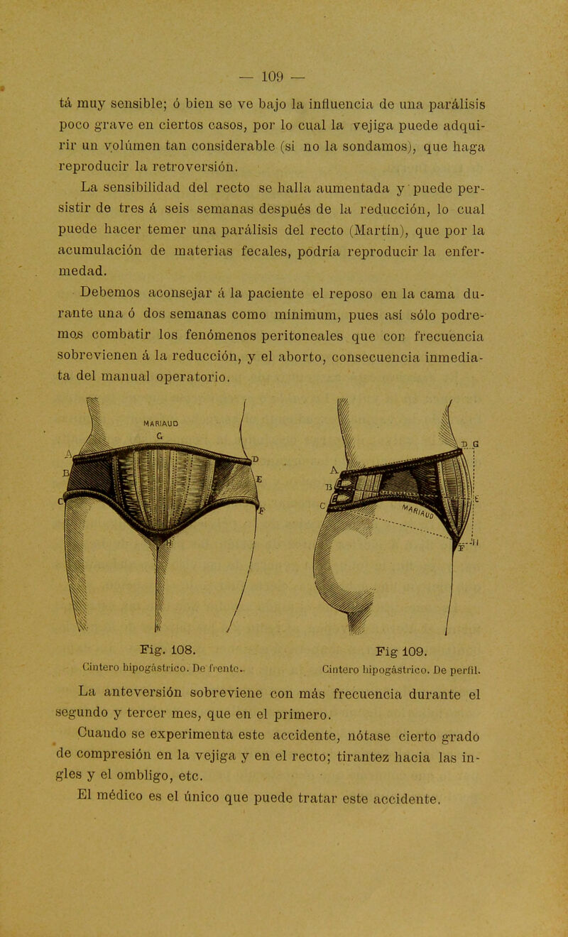 tá muy sensible; ó bien se ve bajo la influencia de una parálisis poco grave en ciertos casos, por lo cual la vejiga puede adqui- rir un volumen tan considerable (si no la sondamos), que haga reproducir la retro versión. La sensibilidad del recto se halla aumentada y puede per- sistir de tres á seis semanas después de la reducción, lo cual puede hacer temer una parálisis del recto (Martín), que por la acumulación de materias fecales, podría reproducir la enfer- medad. Debemos aconsejar á la paciente el reposo en la cama du- rante una ó dos semanas como mínimum, pues así sólo podre- mos combatir los fenómenos peritoneales que con frecuencia sobrevienen á la reducción, y el aborto, consecuencia inmedia- ta del manual operatorio. La anteversión sobreviene con más frecuencia durante el segundo y tercer mes, que en el primero. Cuando se experimenta este accidente, nótase cierto grado de compresión en la vejiga y en el recto; tirantez hacia las in- gles y el ombligo, etc. El médico es el único que puede tratar este accidente. c' Fig. 108. Cintero hipogástrico. De frente^ Fig 109. Cintero hipogástrico. De perfil.