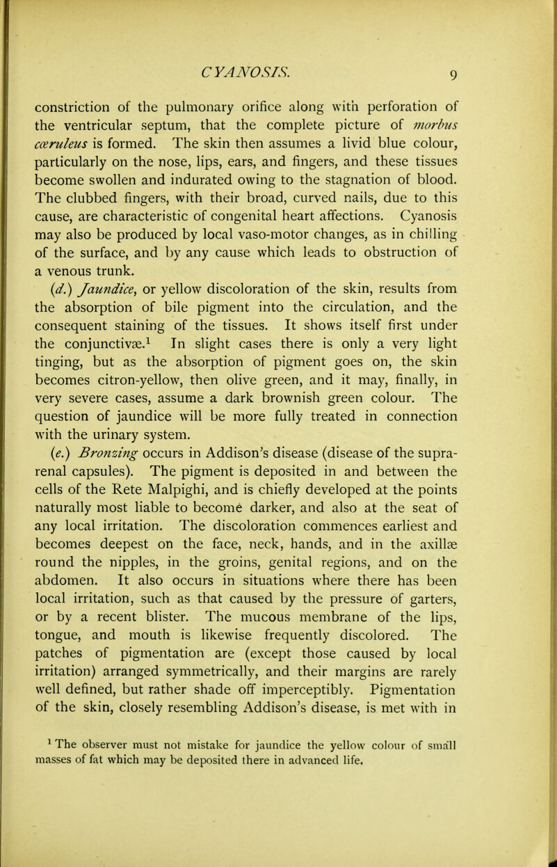 CYANOSIS. constriction of the pulmonary orifice along with perforation of the ventricular septum, that the complete picture of morbus cmruleus is formed. The skin then assumes a livid blue colour, particularly on the nose, lips, ears, and fingers, and these tissues become swollen and indurated owing to the stagnation of blood. The clubbed fingers, with their broad, curved nails, due to this cause, are characteristic of congenital heart affections. Cyanosis may also be produced by local vaso-motor changes, as in chilling of the surface, and by any cause which leads to obstruction of a venous trunk. (^.) Jaundice^ or yellow discoloration of the skin, results from the absorption of bile pigment into the circulation, and the consequent staining of the tissues. It shows itself first under the conjunctivae.^ In slight cases there is only a very light tinging, but as the absorption of pigment goes on, the skin becomes citron-yellow, then olive green, and it may, finally, in very severe cases, assume a dark brownish green colour. The question of jaundice will be more fully treated in connection with the urinary system. (^.) Bronzing occurs in Addison's disease (disease of the supra- renal capsules). The pigment is deposited in and between the cells of the Rete Malpighi, and is chiefly developed at the points naturally most liable to become darker, and also at the seat of any local irritation. The discoloration commences earliest and becomes deepest on the face, neck, hands, and in the axillae round the nipples, in the groins, genital regions, and on the abdomen. It also occurs in situations where there has been local irritation, such as that caused by the pressure of garters, or by a recent blister. The mucous membrane of the lips, tongue, and mouth is Hkewise frequently discolored. The patches of pigmentation are (except those caused by local irritation) arranged symmetrically, and their margins are rarely well defined, but rather shade off imperceptibly. Pigmentation of the skin, closely resembling Addison's disease, is met with in ^ The observer must not mistake for jaundice the yellow colour of small masses of fat which may be deposited there in advanced life.