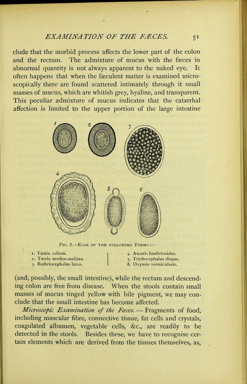 elude that the morbid process affects the lower part of the colon and the rectum. The admixture of mucus with the faeces in abnormal quantity is not always apparent to the naked eye. It often happens that when the fgeculent matter is examined micro- scopically there are found scattered intimately through it small masses of mucus, which are whitish grey, hyaline, and transparent. This peculiar admixture of mucus indicates that the catarrhal affection is limited to the upper portion of the large intestine (and, possibly, the small intestine), while the rectum and descend- ing colon are free from disease. When the stools contain small masses of mucus tinged yellow with bile pigment, we may con- clude that the small intestine has become affected. Microscopic Examination of the Fceces. — Fragments of food, including muscular fibre, connective tissue, fat cells and crystals, coagulated albumen, vegetable cells, &c., are readily to be detected in the stools. Besides these, we have to recognise cer- tain elements which are derived from the tissues themselves, as. Fig. 8.—Eggs of the following Forms :— 1. Taenia solium. 2. Taenia medioomellata. 3. Bothriocephalus latus. 4. Ascaris lumbricoides. 5. Trichocephalus dispar. 6. Oxyuris vermicularis.