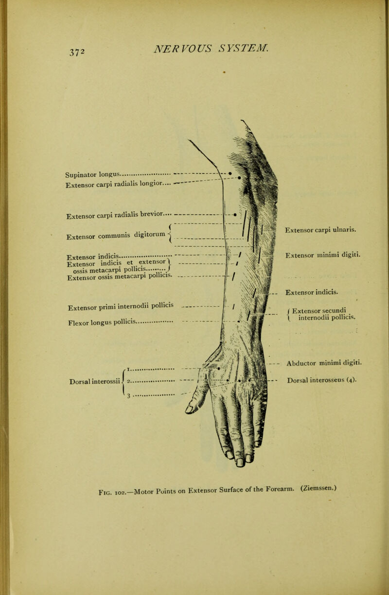 Supinator longus Extensor carpi radialis longior Extensor carpi radialis brevior Extensor communis digitorum j Extensor indicis ••• Extensor indicis et extensor \ ossis metacarpi pollicis........._J Extensor ossis metacarpi poUicis. Extensor primi internodii poUicis Flexor longus pollicis Dorsal interossii Extensor carpi ulnaris. Extensor minimi digiti. Extensor indicis. / Extensor secundi ( internodii pollicis. Abductor minimi digiti. Dorsal interosseus (4).