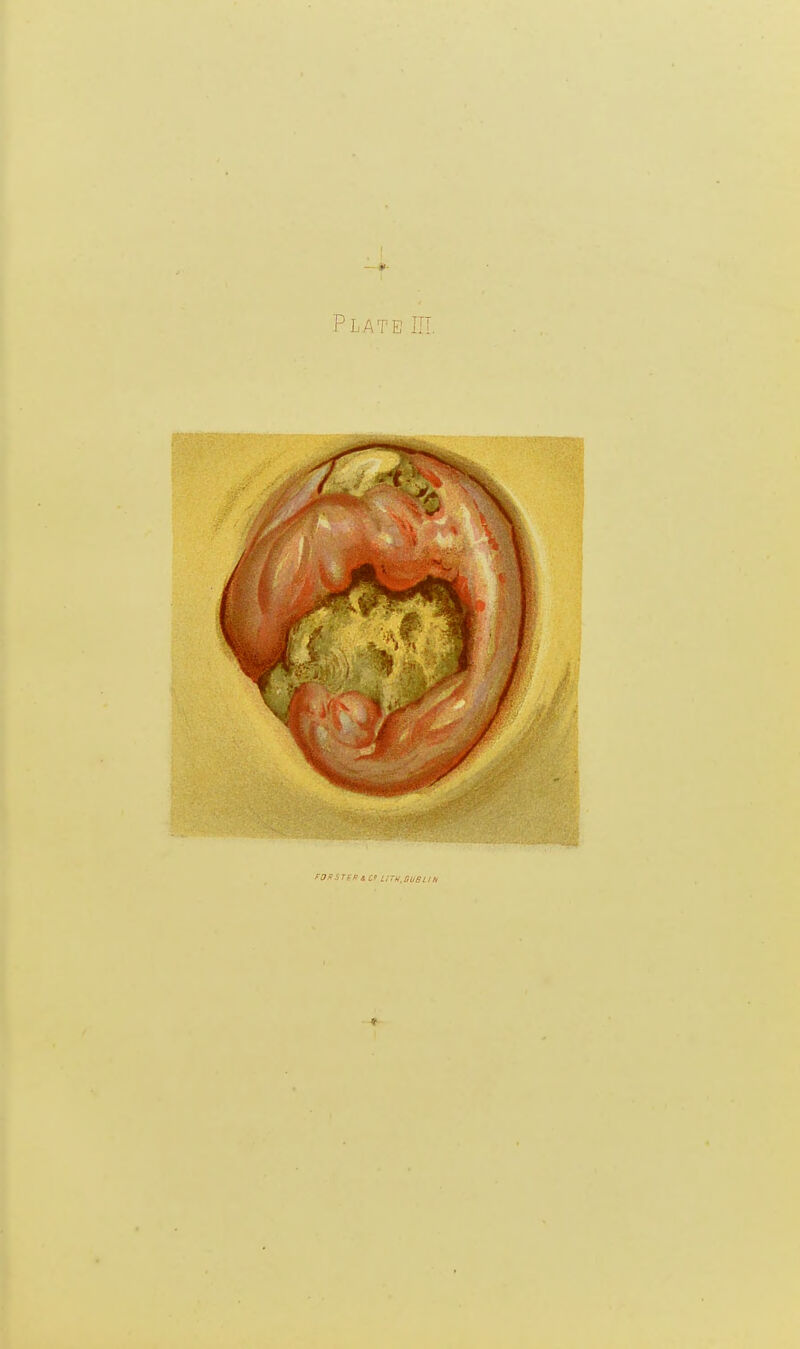 Plate III.