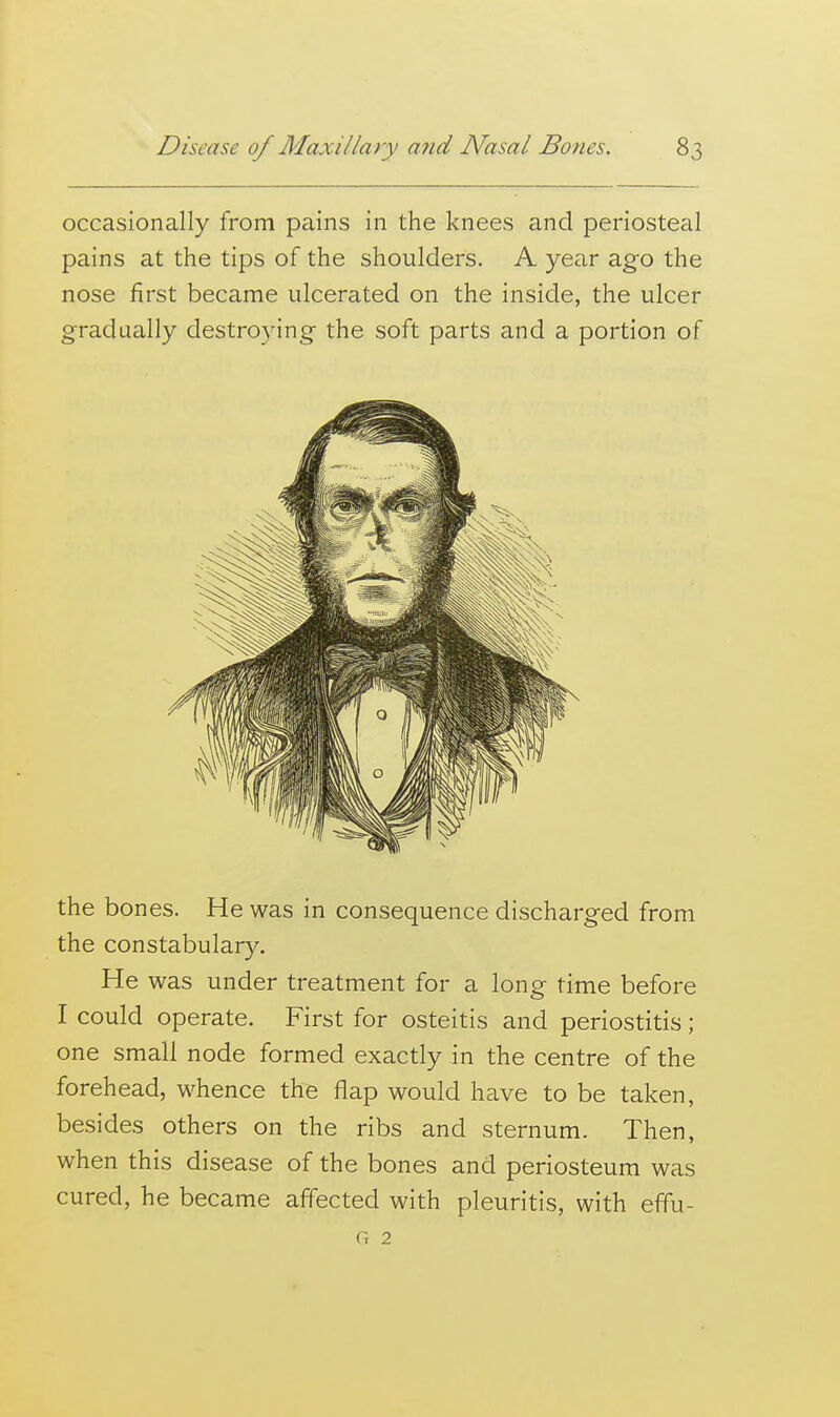 occasionally from pains in the knees and periosteal pains at the tips of the shoulders. A year ago the nose first became ulcerated on the inside, the ulcer gradually destroying the soft parts and a portion of the bones. He was in consequence discharged from the constabulary. He was under treatment for a long time before I could operate. First for osteitis and periostitis; one small node formed exactly in the centre of the forehead, whence the flap would have to be taken, besides others on the ribs and sternum. Then, when this disease of the bones and periosteum was cured, he became affected with pleuritis, with effu- G 2