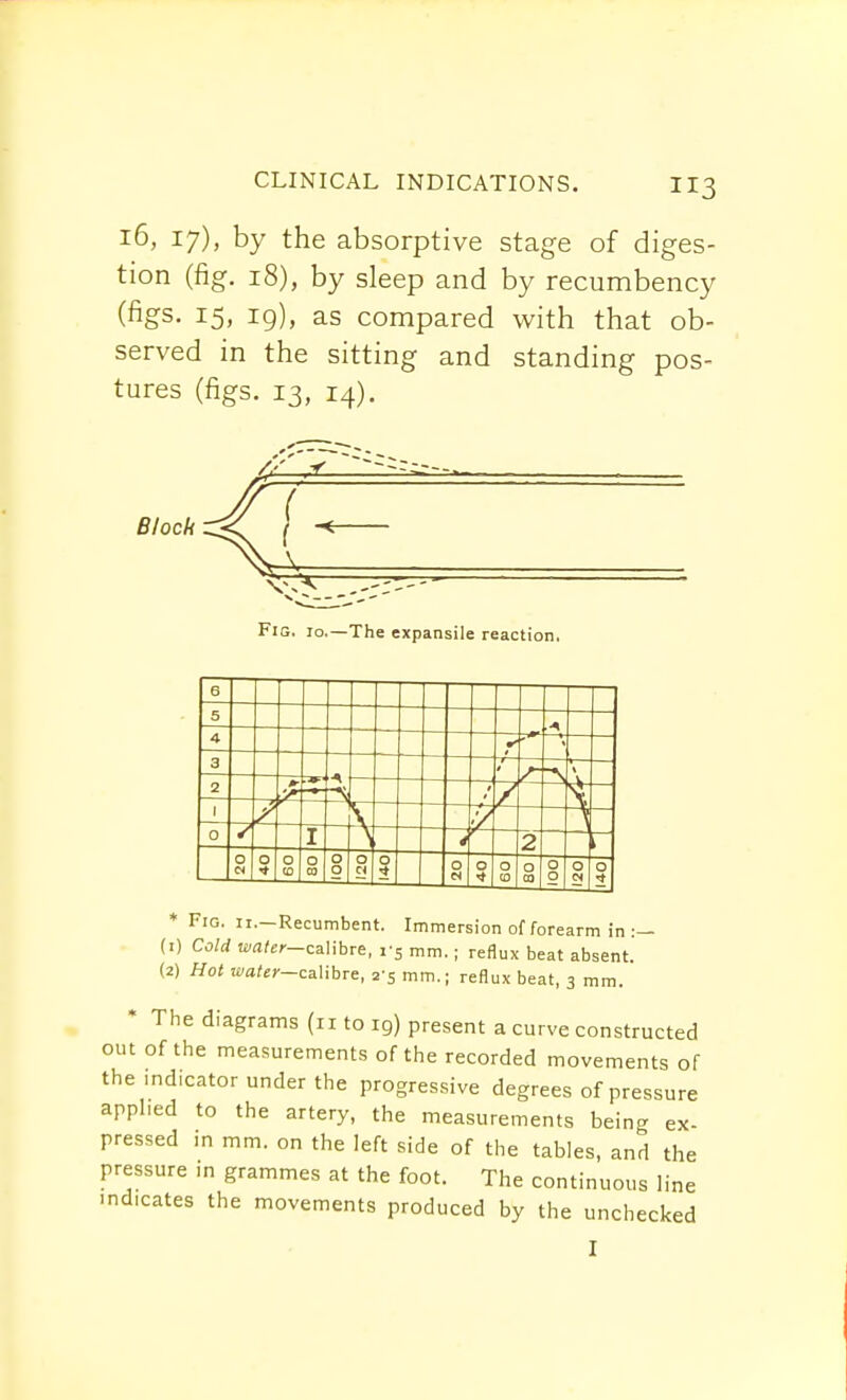 3 16, 17), by the absorptive stage of diges- tion (fig. 18), by sleep and by recumbency (figs. 15, 19), as compared with that ob- served in the sitting and standing pos- tures (figs. 13, 14). Block Fig. 10.—The expansile reaction. * Fig. 11.—Recumbent. Immersion of forearm in (1) Cold water-cMbre, vs mm. ; reflux beat absent (2) Hot water-calibre, 2-5 mm.; reflux beat, 3 mm. ' The diagrams (n to 19) present a curve constructed out of the measurements of the recorded movements of the indicator under the progressive degrees of pressure applied to the artery, the measurements being ex- pressed in mm. on the left side of the tables, and the pressure m grammes at the foot. The continuous line indicates the movements produced by the unchecked