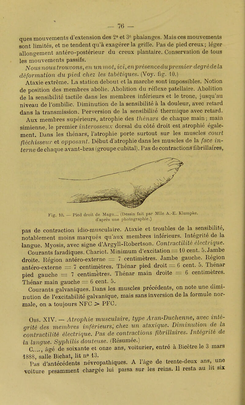 — To- ques mouvements d'extension des 2° et 3° phalanges. Mais ces mouvements sont limités, et ne tendent qu'à exagérer la griffe. Pas de pied creux; léger allongement antéro-postérieur du creux plantaire. Conservation de tous les mouvements passifs. Nousnous trouvons, en unmot, ici,enprésencedupreinier degrédela déformation du pied chez les tabètiques. (Voy. fie. 10.) Ataxie extrême. La station debout et la marche sont impossibles. Notion de position des membres abolie. Abolition du réflexe patellaire. Abolition de la sensibilité tactile dans les membres inférieurs et le tronc, jusqu'au niveau de l'ombilic. Diminution de la sensibilité à la douleur, avec retard dans la transmission. Perversion de la sensibilité thermique avec retard. Aux membres supérieurs, atrophie des thénars de chaque main; main simienne, le premier interosseux dorsal du côté droit est atrophié égale- ment. Dans les thénars, l'atrophie porte surtout sur les muscles court fléchisseur et opposant. Début d'atrophie dans les muscles de la fa.ce in- terne de chaque avant-bras (groupe cubital). Pas de contractions fibrillaires, Fig. 10. — Pied droit de Magn... (Dessin fait par Mlle A.-E. Klurapke. d'après une photographie.) pas de contraction idio-musculaire. Ataxie et troubles de la sensibilité, notablement moins marqués qu'aux membres inférieurs. Intégrité de la langue. Myosis, avec signe d'Argyll-Robertson. Gontractilité électrique. Courants faradiques. Chariot. Minimum d'excitation = 10 cent. 5. Jambe droite. Région antéro-externe = 7 centimètres. Jambe gauche. Région antéro-externe = 7 centimètres. Thénar pied droit = 6 cent. 5. Thénar pied gauche = 7 centimètres. Thénar main droite = 6 centimètres. Thénar main gauche = 6 cent. 5. Courants galvaniques. Dans les muscles précédents, on note une dimi- nution de l'excitabilité galvanique, mais sans inversion de la formule nor- male, on a toujours NFC > PFC, Obs. XIV. — Atrophie musculaire, type Aran-Duchenne, avec inté- grité des membres inférieurs, chez un ataxique. Diminution de la contractilité électrique. Pas de contractions fibrillaires. Intégrité de la langue. Syphilis douteuse. (Résumée.) C...,, âgé de soixante et onze ans, voiturier, entré à Bicctro le 3 mars 1888, salle Bichat, lit n» 13. Pas d'antécédents névropathiques. A l'âge de trente-deux ans, une voiture pesamment chargée lui passa sur les reins. 11 resta au ht six