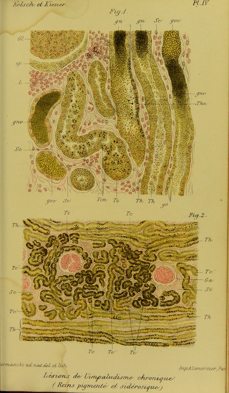 Fl.LV Se/ S^oc/ TVy' Te/ [mpALancrcicr^ Peu