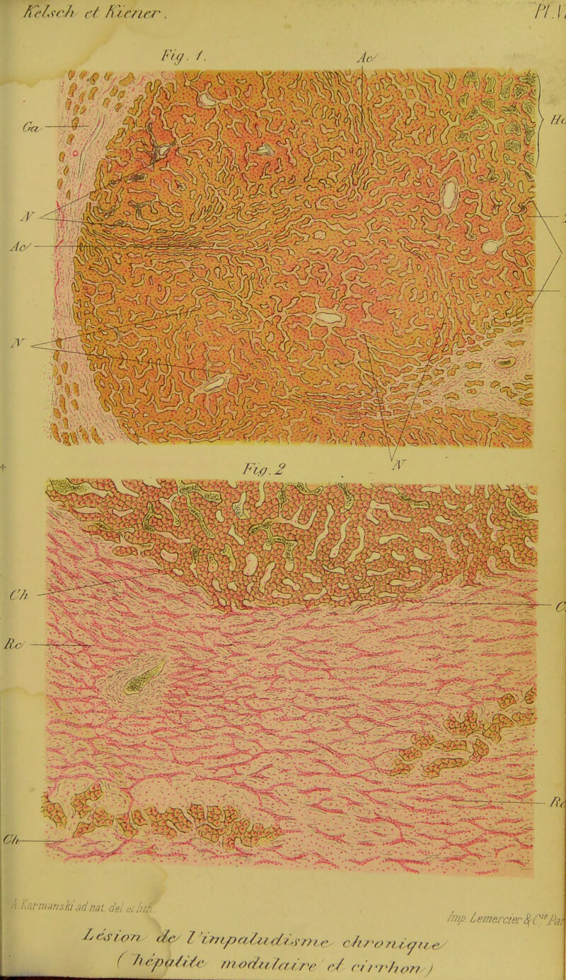 h^f lsch et filmer. Fi(J /. Acy /nift Lemp.rcierSi;C'P()! ^f'^'po/f'/c modatain' r/ rt/ rhor? J