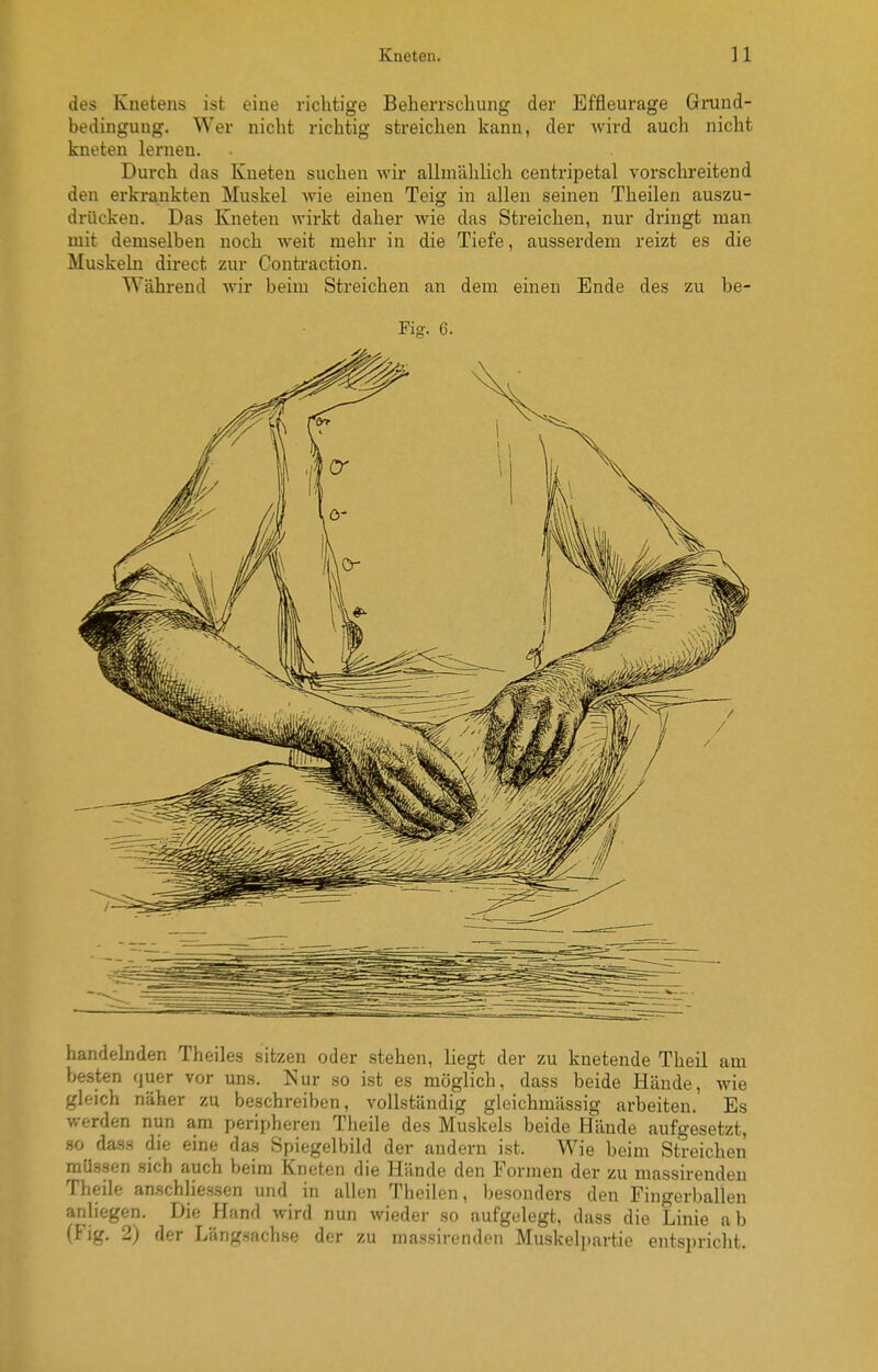 des Knetens ist eine richtige Beherrschung der Effleurage Grund- bedingung. Wer nicht richtig streichen kann, der wird auch nicht kneten lernen. Durch das Kneten suchen wir allmählich centripetal vorschreitend den erkrankten Muskel wie einen Teig in allen seinen Theilen auszu- drücken. Das Kneten wirkt daher wie das Streichen, nur dringt man mit demselben noch weit mehr in die Tiefe, ausserdem reizt es die Muskeln direct zur Contraction. Während wir beim Streichen an dem einen Ende des zu be- Fig. 6. handelnden Theiles sitzen oder stehen, liegt der zu knetende Theil am besten quer vor uns. Nur so ist es möglich, dass beide Hände, wie gleich näher zu beschreiben, vollständig gleichmässig arbeiten. Es werden nun am peripheren Theile des Muskels beide Hände aufgesetzt, so dasH die eine das Spiegelbild der andern ist. Wie beim Streichen müssen sich auch beim Kneten die Hände den Formen der zu massirenden Theile anschliessen und in allen Theilen, besonders den Fingerballen anliegen. Die Hand wird nun wieder so aufgelegt, dass die Linie ab (Fig. 2) der Längsachse der zu massirenden Muskelpartie entspricht.
