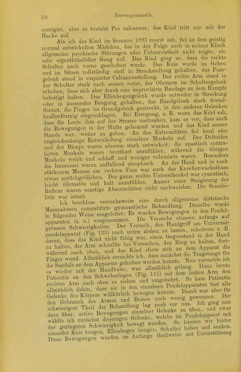 corrigirt, aber es bestellt Pes calcaneus, das Kind tritt nur mit der Hacke auf. , . n ■, -, • l- Als ich das Kind im Sommer 1893 zuerst sab, fiel an dem geistig normal entwickelten Mädcben, das in der Folge auch in meiner Klinik allgemeine psycliiscbe Störungen oder Ueberreiztheit nicbt zeigte, em sehr eigenthümlicber Gang auf. Das Kind ging so, dass die rechte Schulter nach vorne geschoben wurde. Das Kme wurde im (xehen und im Sitzen vollständig steif in Streckstellung gehalten, das l?uss- celenk stand in exquisiter Calcaneusstellung. Der rechte Arm stand m der Schulter stark nach aussen rotirt, der Oberarm im Schultergelenk erhoben, Hess sich aber durch eine improvisirte Bandage an dem Rumpte befestigt halten. Das Ellenbogengelenk wurde entweder m Streckung oder in äusserster Beugung gehalten, das Handgelenk stark dor^^^^^^ flectii-t, die Finger im Gnmdgelenk gestreckt, m den anderen Gelenken krallenförmig eingeschlagen. Bei Erregung, z. B. wenn das Kmd sah dass X Leute ihm auf der Strasse nachsahen, kam es vor,_ dass auch die Bewegungen in der Hüfte gehemmt wurden und das Kmd ausser sLci: war,'weiter zu gehen. An den Extremitäten fiel W ungleichmässige Entwicklung emzelner Muskeln auf. Dei Ueltoides und Ter^icejs waren abnorm stark entwickelt; die spastisch contra- Hrtn Muskl waren bretthart anzufühlen, während die ubr^^^^^^^^ Muskeln weich und schlaff und weniger voluminös waren. Besonders die Interossei waren auffallend atrophisch. An der Hand und m noch Srkerem Maasse am rechten Fuss war auch das Knochenwachsthum Is zu'üfkgeblieben. Der ganze rechte Unterschenkel ^^^^^^^f^^ Ipicht ödematös und kalt anzufühlen. Ausser emer bteigerung aer Reflexe wen sonstige Abnormitäten nicht nachweisbar. Die Sensibi- Ih beschloBS versuchsweise eine durch allgemeine diätetische halten, der Arm schEellte l)»' y^«»^' ^„ Apparat die „ährend errcl dS .u'^chst die Tra/sLge für Finger wund. AiimaMicn erieicuiB x ' ^, irnnTite Nun versuchte ich die Sandale an dem Apparate gehalten we d^^^^^^^ ^^^^^^ es wieder mit der Handhabe, ^fs allmählich ge^^n Patientin an den Schwebermgen (Fig^ l^''eklt. So kam Patientin h^.r dasT S Än^zelnefptdelapparaten fast ^le allmählich clanin, aass sie v^-r,T,fo n-imit war aber für Gelenke des Körpers wiUkürhch \^^\l2''''^J.'''^^^^^ Der den Gebrauch des Armes und Beines nocü J^eni = schwierigste Theil der Behandlung lag noch v^^^^  üben imd^zwar dazu über, active Bewegungen eiiizelnei ^^^^^'.^ ™p^,,^elkpparat mit wählte ich zunächst diejenigen Gelenke, Sen wir hinter der geringsten Schwierigkeit bewegt ^^den So eijten einander Knie beugen, EUenbogen beugen, SÄ ^^ff^nterstützung Diese Bewegungen wurden im Anfange theüweise mit