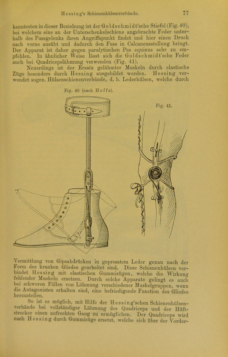 kanntesten in dieser Beziehung ist der Groldsclimidt'sclie Stiefel (Fig. 40), bei welchem eine an der Unterschenkelschiene angebrachte Feder unter- halb des Fussgelenks ihren Angriffspunkt findet und hier einen Druck nach vorne ausübt und dadurch den Fuss in Calcaneusstellung bringt. Der Apparat ist daher gegen paralytischen Pes equinus sehr zu em- pfehlen. In ähnlicher Weise lässt sich die Goldschmidt'sche Feder auch bei Quadricepslähmung verwenden (Fig. 41). Neuerdings ist der Ersatz gelähmter Muskeln durch elastische Züge besonders durch Hessing ausgebildet worden. Hessing ver- wendet sogen. Hülsenschienenverbände, d. h. Lederhülsen, welche durch Fig. 40 (nach Hoffa). Vermittlung von Gipsabdrücken in gepresstem Leder genau nach der Form des kranken Gliedes gearbeitet sind. Diese Schienenhülsen ver- bindet Hessing mit elastischen Gummizügen, welche die Wirkung fehlender Muskeln ersetzen. Durch solche Apparate gelingt es auch bei schweren Fällen von Lähmung verschiedener Muskelgruppen, wenn die Antagonisten erhalten sind, eine befriedigende Function des Gliedes herzustellen. So ist es möglich, mit Hilfe der Hessing'schen Schienenhülsen- verbände bei vollständiger Lähmung des Quadriceps und der Hüft- strecker emen aufrechten Gang zu ermöglichen. Der Quadriceps wird nach Hessing durch Gummizüge ersetzt, welche sich über der Vorder-