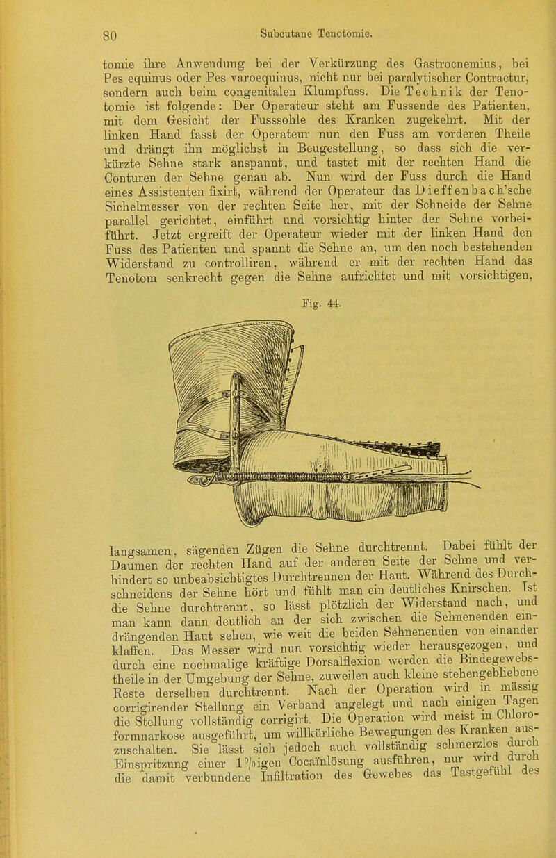 Subcutane Tenotomie, tomie ilire Anwendung bei der Verkürzung des Gastrocnemius, bei Pes equinus oder Pes varoequinus, nicht nur bei paralytischer Contractur, sondern auch beim congenitalen Klumpfuss. Die Technik der Teno- tomie ist folgende: Der Operateur steht am Fussende des Patienten, mit dem Gesicht der Fusssohle des Kranken zugekehrt. Mit der linken Hand fasst der Operateur nun den Fuss am vorderen Theile und drängt ihn möglichst in Beugestellung, so dass sich die ver- kürzte Sehne stark anspannt, und tastet mit der rechten Hand die Conturen der Sehne genau ab. Nun wird der Fuss durch die Hand eines Assistenten fixirt, während der Operateur das Dieffenbach'sche Sichelmesser von der rechten Seite her, mit der Schneide der Sehne parallel gerichtet, einführt und vorsichtig hinter der Sehne vorbei- führt. Jetzt ergreift der Operateur wieder mit der linken Hand den Fuss des Patienten und spannt die Sehne an, um den noch bestehenden Widerstand zu controUii-en, während er mit der rechten Hand das Tenotom senkrecht gegen die Sehne aufrichtet und mit vorsichtigen, Fig. 44. langsamen, sägenden Zügen die Sehne durchtrennt. Dabei fühlt der Daumen der rechten Hand auf der anderen Seite der Sehne und ver- hindert so unbeabsichtigtes Durchtrennen der Haut. Währeiid des Dui-ch- schneidens der Sehne hört und fühlt man ein deutliches Knirschen, ist die Sehne durchtrennt, so lässt plötzUch der Widei-stand nach, und man kann dann deuthch an der sich zwischen die Sehnenenden ein- drängenden Haut sehen, wie weit die beiden Sehnenenden von emander klaffen. Das Messer wird nun vorsichtig wieder herausgezogen, und durch eine nochmalige kräftige Dorsalflexion werden die Bmdegewebs- theile in der Umgebung der Sehne, zuweilen auch kleme stehengebhebene Reste derselben durchtrennt. Nach der Operation wird _ m massig corrigirender Stellung ein Verband angelegt und nach emigen lagen die Stellung vollständig corrigirt. Die Operation wu-d meist m tliioro- formnarkose ausgeführt, um willkürliche Bewegungen des Kranken aus- zuschalten. Sie lässt sich jedoch auch vollständig schmerzlos durch Einspritzung einer l»/nigen Cocainlösung ausführen, nur ^^-^^^^l die damit verbundene Infiltration des Gewebes das Tastgefuhl des