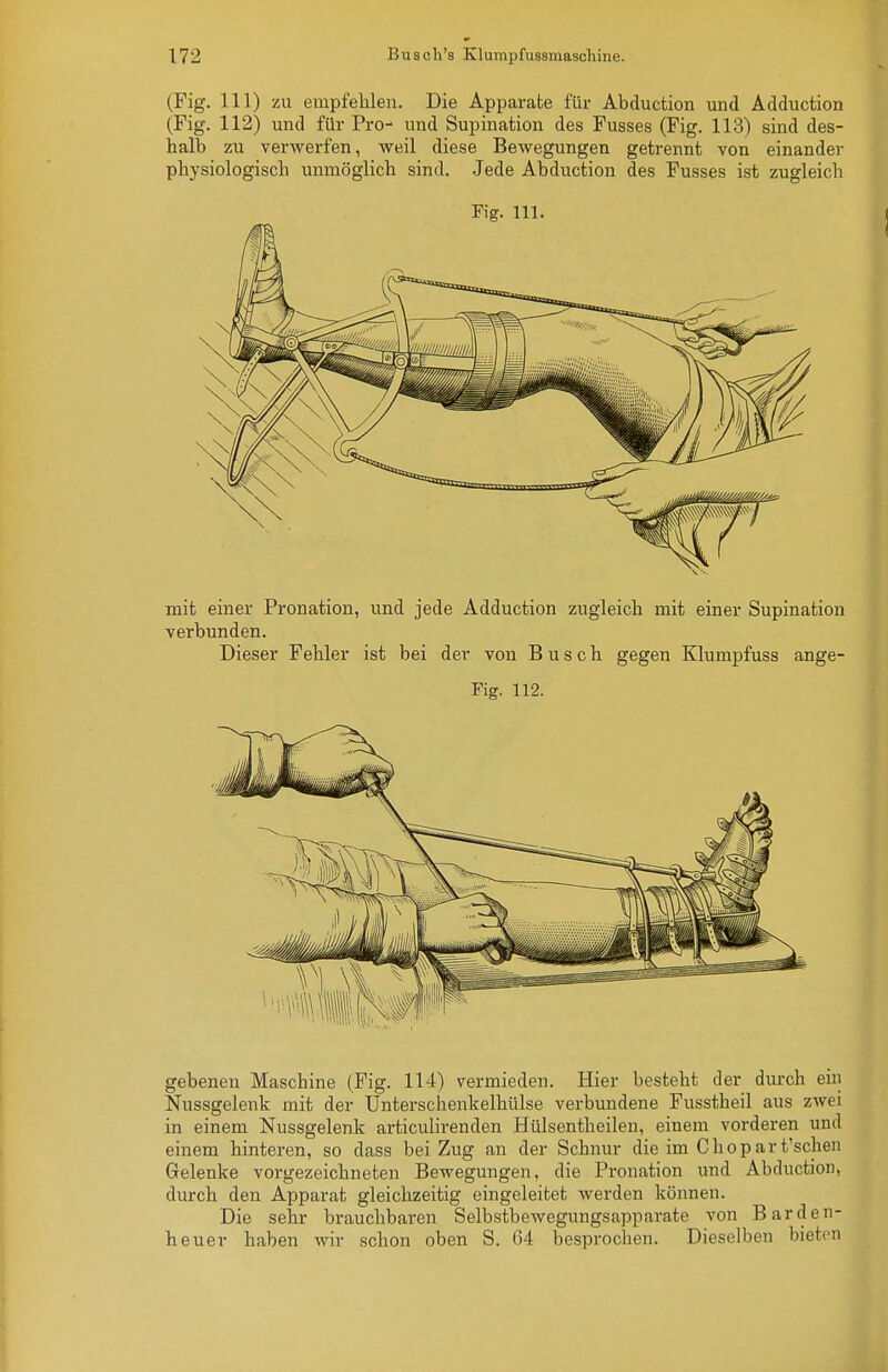 (Fig. III) zu empfehlen. Die Apparate für Abduction und Adduction (Fig. 112) und für Pro- und Supination des Fusses (Fig. 113) sind des- halb zu verwerfen, weil diese Bewegungen getrennt von einander physiologisch unmöglich sind. Jede Abduction des Fusses ist zugleich Fig. III. mit einer Pronation, und jede Adduction zugleich mit einer Supination verbunden. Dieser Fehler ist bei der von Busch gegen Klumpfuss ange- Fig. 112. gebenen Maschine (Fig. 114) vermieden. Hier besteht der durch ein Nussgelenk mit der Unterschenkelhülse verbundene Fusstheil aus zwei in einem Nussgelenk articulirenden Hülsentheilen, einem vorderen und einem hinteren, so dass bei Zug an der Schnur die im Choparfschen Gelenke vorgezeichneten Bewegungen, die Pronation und Abduction, durch den Apparat gleichzeitig eingeleitet werden können. Die sehr brauchbaren Selbstbewegungsapparate von Barden- heuer haben wir schon oben S. 64 besprochen. Dieselben bieten