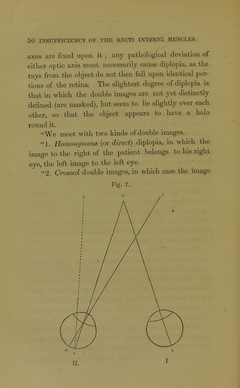 axes are fixed upon it ; any pathological deviation of either optic axis must necessarily cause diplopia, as the rays from the object do not then fall upon identical por- tions of the retina. The slightest degree of diplopia is that in which the double images are not yet distinctly defined (are masked), but seem to lie slightly over each, other, so that the object appears to have a halo round it. We meet with two kinds of double images. 1. Homonymous (or direct) diplopia, in which the image to the right of the patient belongs to his right eye, the left image to the left eye. 2. Crossed double images, in which case the image Fig. 7.