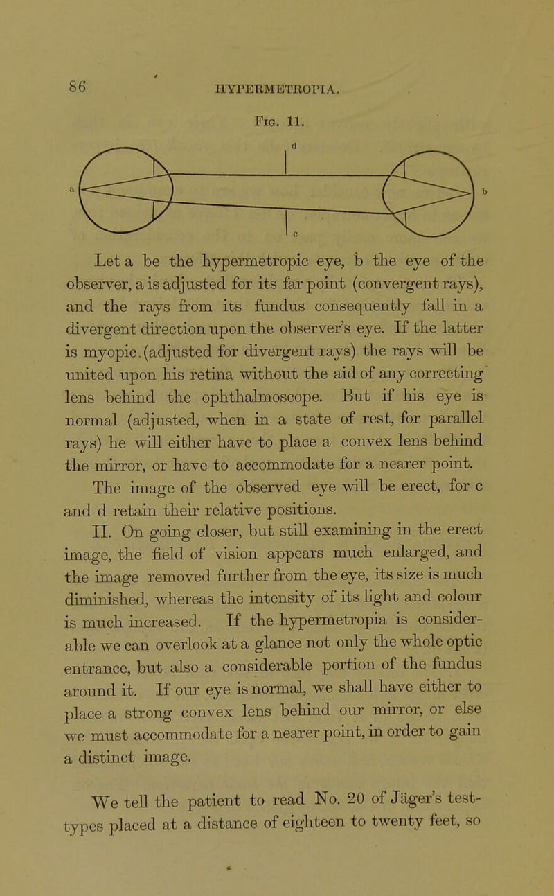 Fig. 11. Let a be the liypermetropic eye, b tlie eye of the observer, a is adjusted for its far point (convergent rays), and the rays from its fundus consequently fall in a divergent direction upon the observer's eye. If the latter is myopic.(adjusted for divergent rays) the rays will be united npon his retina without the aid of any correctmg lens behind the ophthalmoscope. But if his eye is normal (adjusted, when in a state of rest, for parallel rays) he will either have to place a convex lens behind the mirror, or have to accommodate for a nearer point. The image of the observed eye will be erect, for c and d retain their relative positions. II. On going closer, but stiU examining in the erect image, the field of vision appears much enlarged, and the image removed further from the eye, its size is much diminished, whereas the intensity of its hght and colour is much mcreased. If the hypermetropia is consider- able we can overlook at a glance not only the whole optic entrance, but also a considerable portion of the fundus around it. If our eye is normal, we shall have either to place a strong convex lens behind our mirror, or else we must accommodate for a nearer point, in order to gain a distinct image. We teU the patient to read No. 20 of Jager's test- types placed at a distance of eighteen to twenty feet, so