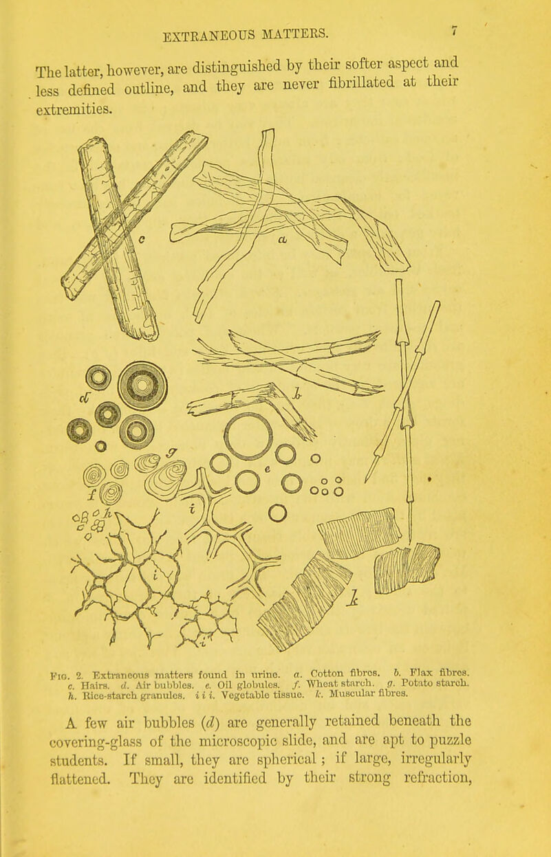 EXTRANEOUS MATTERS. The latter, however, are distinguished by their softer aspect less defined outline, and they are never fibnUated at 1 extremities. Kio. 2. Extraneous matters found in urine, a. Cotton fibres. 6. Flax fibres, c. Hairs, d. Air bubbles, e. Oil globules. /. Wheat starch, g. Potato starch, ft. Rice-starch granules, i i i. Vcgetablo tissue tc. Muscular fibres. A few air bubbles (d) are generally retained beneath the covering-glass of the microscopic slide, and are apt to puzzle students. If small, they are spherical; if large, irregularly flattened. They are identified by their strong refraction,