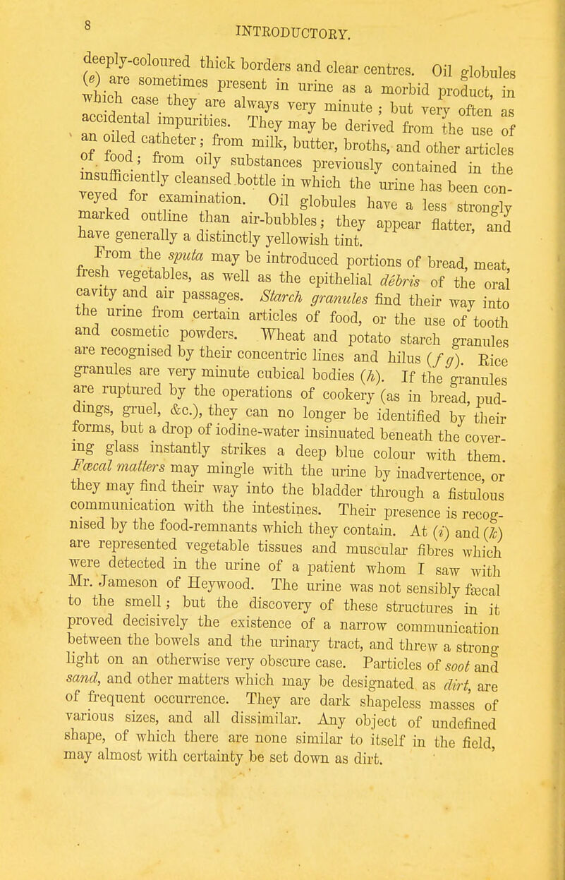 deeply-coloured thick borders and clear centres. Oil globules 00 are sometimes present in nrine as a morbid product in which caSe they are always very minute ; but ve' a accidental impurities. They may be derived from the use of ■ an oiled catheter; from milk, butter, broths, and other aXles rnJffi ^ 0ll^s^bstances Previously contained in the ^sufficiently cleansed bottle in which the urine has been con- JJL +e1Xami+Ttl0n-. 0il ^ohuleB have a less strongly marked outline than air-bubbles,- they appear flatter, and have generally a distinctly yellowish tint. From the sputa may be introduced portions of bread, meat fresh vegetables, as well as the epithelial debris of the oral cavity and air passages. Starch granules find their way into the urine from certain articles of food, or the use of tooth and cosmetic powders. Wheat and potato starch granules are recognised by their concentric lines and hilus (//) Eice granules are very minute cubical bodies (h). If the granules are ruptured by the operations of cookery (as in bread, pud- dings, gruel, &c), they can no longer be identified by their iorms, but a drop of iodine-water insinuated beneath the cover mg glass instantly strikes a deep blue colour with them Focal matters may mingle with the urine by inadvertence or they may find their way into the bladder through a fistulous communication with the intestines. Their presence is recog- nised by the food-remnants which they contain. At (i) and (7c) are represented vegetable tissues and muscular fibres which were detected in the urine of a patient whom I saw with Mr. Jameson of Heywood. The urine was not sensibly fiscal to the smell; but the discovery of these structures in it proved decisively the existence of a narrow communication between the bowels and the urinary tract, and threw a strono- light on an otherwise very obscure case. Particles of soot and sand, and other matters which may be designated as dirt, are of frequent occurrence. They are dark shapeless masses of various sizes, and all dissimilar. Any object of undefined shape, of which there are none similar to itself in the field may almost with certainty be set down as dirt.