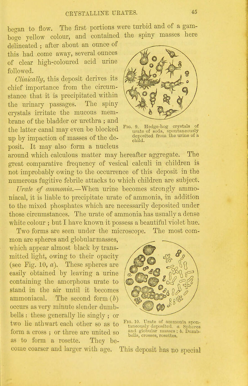 Fig. 9. Hedge-hog crystals of urate of soda, spontaneously- deposited from the urine of a child. began to flow. The first portions were turbid and of a gam- boge yellow colour, and contained the spiny masses here delineated ; after about an ounce of this had come away, several ounces of clear high-coloured acid urine followed. Clinically, this deposit derives its chief importance from the circum- stance that it is precipitated within the urinary passages. The spiny crystals irritate the mucous mem- brane of the bladder or urethra ; and the latter canal may even be blocked up by impaction of masses of the de- posit. It may also form a nucleus around which calculous matter may hereafter aggregate. The great comparative frequency of vesical calculi in children is not improbably owing to the occurrence of this deposit in the numerous fugitive febrile attacks to which children are subject. Urate of ammonia.—When urine becomes strongly amnio- niacal, it is liable to precipitate urate of ammonia, in addition to the mixed phosphates which are necessarily deposited under those circumstances. The urate of ammonia has usually a dense white colour ; but I have known it possess a beautiful violet hue. Two forms are seen under the microscope. The most com- mon are spheres and globular masses, which appear almost black by trans- mitted light, owing to their opacity (see Fig. 10, a). These spheres are easily obtained by leaving a urine containing the amorphous urate to stand in the air until it becomes ammoniacal. The second form (b) occurs as very minute slender dumb- bells : these generally lie singly ; or two lie athwart each other so as to form a cross ; or three are united so as to form a rosette. They be- come coarser and larger with age. This deposit has no special Fio. 10 Urate of ammonia spon- taneously deposited, a. Spheres and globular masses ; 6. Dumb- bells, crosses, rosottes.
