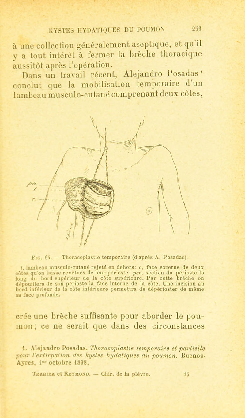 ù line collection généralement aseptique, et qu'il y a tout intérêt à fermer la brèche thoracique aussitôt après l'opération. Dans un travail récent, Alejandro Posadas ' conclut que la mobilisation temporaire d'un lambeau musculo-cutané comprenant deux côtes. FiG. 61. — Thoracoplastie temporaire (d'après A. Posadas). 1, lambeau masculo-cutaaé rejeté en dehors; c, face externe de deux cotes qu'on laisse revAtues de leur périoste ; per, section du périoste la long du bord supérieur de la côte supérieure. Par cette Drèohe on dépouillera de S'in p^'^rioste la face interne de la côte. Une incision au bord inférieur de la cote inférieure permettra de dépérioster de même sa face profonde. crée une brèche suffisante pour aborder le pou- mon; ce ne serait que dans des circonstances 1. Alejandro Posadas. Thoracoplastie temporaire et partielle pour Vextirpaiion des kijstes hydaliques du poumon. Buenos- Ayres, 1 octobre 1898. TeKBiEH et Reymond. — Chir. de la plèvre. 15