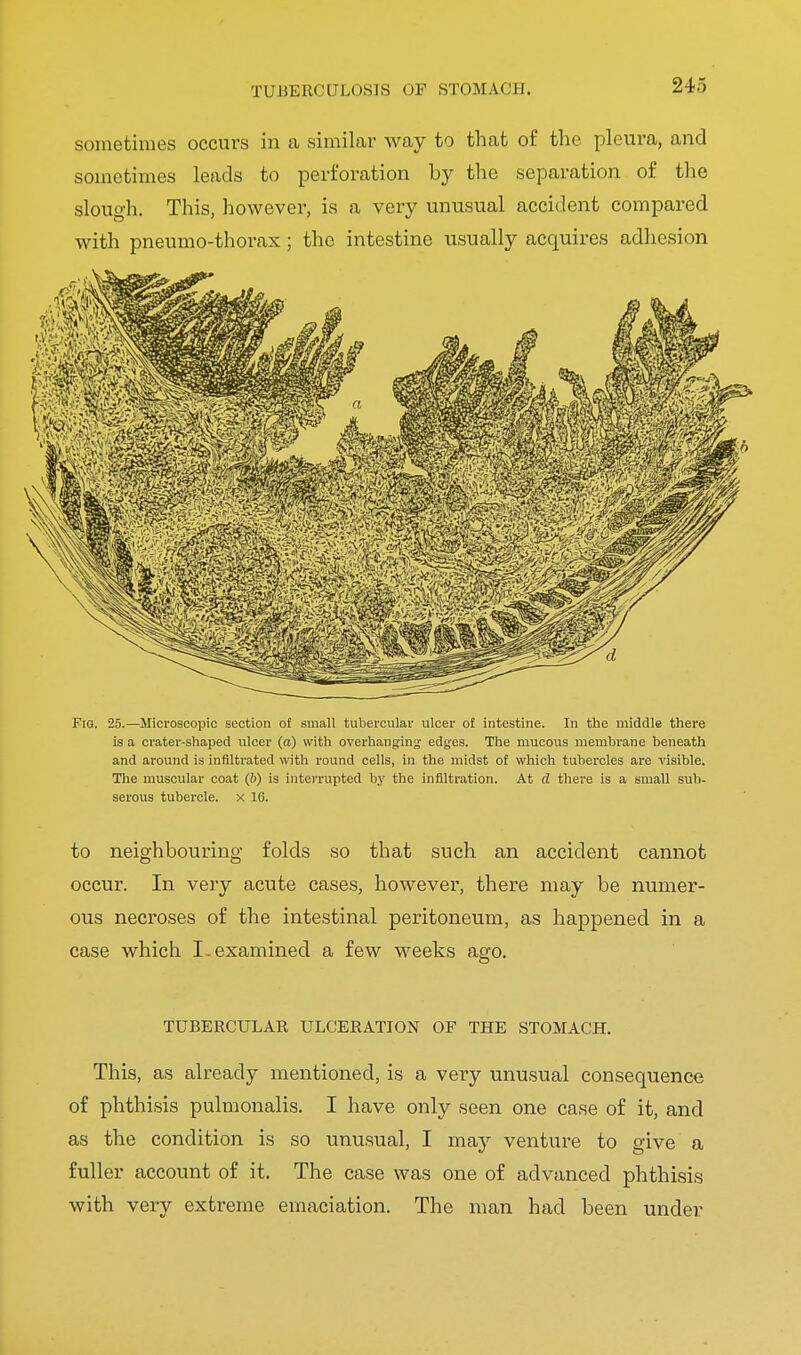 TUBERCULOSIS OF STOMACH. sometimes occurs in a similar way to that of the pleura, and sometimes leads to perforation by the separation of the slough. This, however, is a very unusual accident compared with pneumo-thorax ; the intestine usually acquires adhesion Fig. 25.—Microscopic section of small tubercular ulcer of intestine. In the middle there is a crater-shaped ulcer (a) with overhanging edges. The mucous membrane beneath and around is infiltrated with round cells, in the midst of which tubercles are visible. The muscular coat (6) is interrupted by the infiltration. At d there is a small sub- serous tubercle, x 16. to neighbouring folds so that such an accident cannot occur. In very acute cases, however, there may be numer- ous necroses of the intestinal peritoneum, as happened in a case which I .examined a few weeks ago. TUBERCULAR ULCERATION OF THE STOMACH. This, as already mentioned, is a very unusual consequence of phthisis pulmonalis. I have only seen one case of it, and as the condition is so unusual, I may venture to give a fuller account of it. The case was one of advanced phthisis with very extreme emaciation. The man had been under