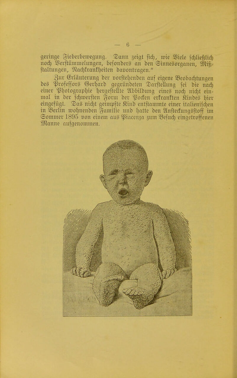 geringe gteberbeiDcgung. ®ann geigt [id), rcic SSiele fdjUejäüd) noä) 93erftüiuniehingen, be[onber§ an ben ©inneSorganen, 3Jii^= ftaltungen, ^fiad^franf'I^eiten bauontragen. 3nr ®rläuterung bev t)ovfleI)enben auf eigene Seobad)tungcn be§ $rofef[or§ @ert)orb gegrünbeten SDnrftellung fei bie nad) einer ^I)otograpt)ic I)ergefteHte 5HbbiIbnng eineS nod) nic^t ein- mal in ber fd)n)erften §ornt ber ^'ocfen erfranften kinhe§ i)kv eingefügt. S)a§ nidjt geimpfte S^inb entftannnte einer italienifd)en in Berlin n)ot)nenben ^Jainilie nnb {)atte ben 2lnfte(fnng§ftoff im (Sommer 1895 uon einem au§ ^taccnga gum ^efud) eingetroffenen S[Ranne aufgenommen.