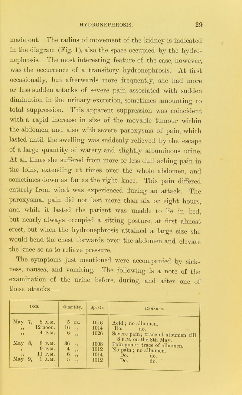 made out. The radius of movement of the kidney is indicated in the diagram (Fig. 1), also the space occupied by the hydro- nephrosis. The most interesting feature of the case, however, was the occurrence of a transitory hydronephrosis. At first occasionally, but afterwards more frequently, she had more or less sudden attacks of severe pain associated with sudden diminution in the urinary excretion, sometimes amounting to total suppression. This apparent suppression was coincident with a rapid increase in size of the movable tumour within the abdomen, and also with severe paroxysms of pain, which lasted until the swelling was suddenly relieved by the escape of a large quantity of watery and slightly albuminous urine. At all times she suffered from more or less dull aching pain in the loins, extending at times over the whole abdomen, and sometimes down as far as the right knee. This pain differed entirely from what was experienced during an attack. The paroxysmal pain did not last more than six or eight hours,, and while it lasted the patient was unable to lie in bed, but nearly always occupied a sitting posture, at first almost erect, but when the hydronephrosis attained a large size she would bend the chest forwards over the abdomen and elevate the knee so as to relieve pressure. The symptoms just mentioned were accompanied by sick- ness, nausea, and vomiting. The following is a note of the examination of the urine before, during, and after one of these attacks:— 1889. Quantity. Sp. Gr. Remarks. May 7, S a.m. ,, 12 noon. ,, 4 P.M. 16 6 5 oz. 1016 1014 1026 Acid; no albumen. Do. do. Severe pain; trace of albumen till May 8, 8 p.m. , 9 P.M. „ 11 P.M. May 9, 1 a.m. 36 4 6 5 1008 1012 1014 1012 8 P.M. on the 8th May. Pain gone ; trace of albumen. No pain ; no albumen. 3) Do. do. Do. do.