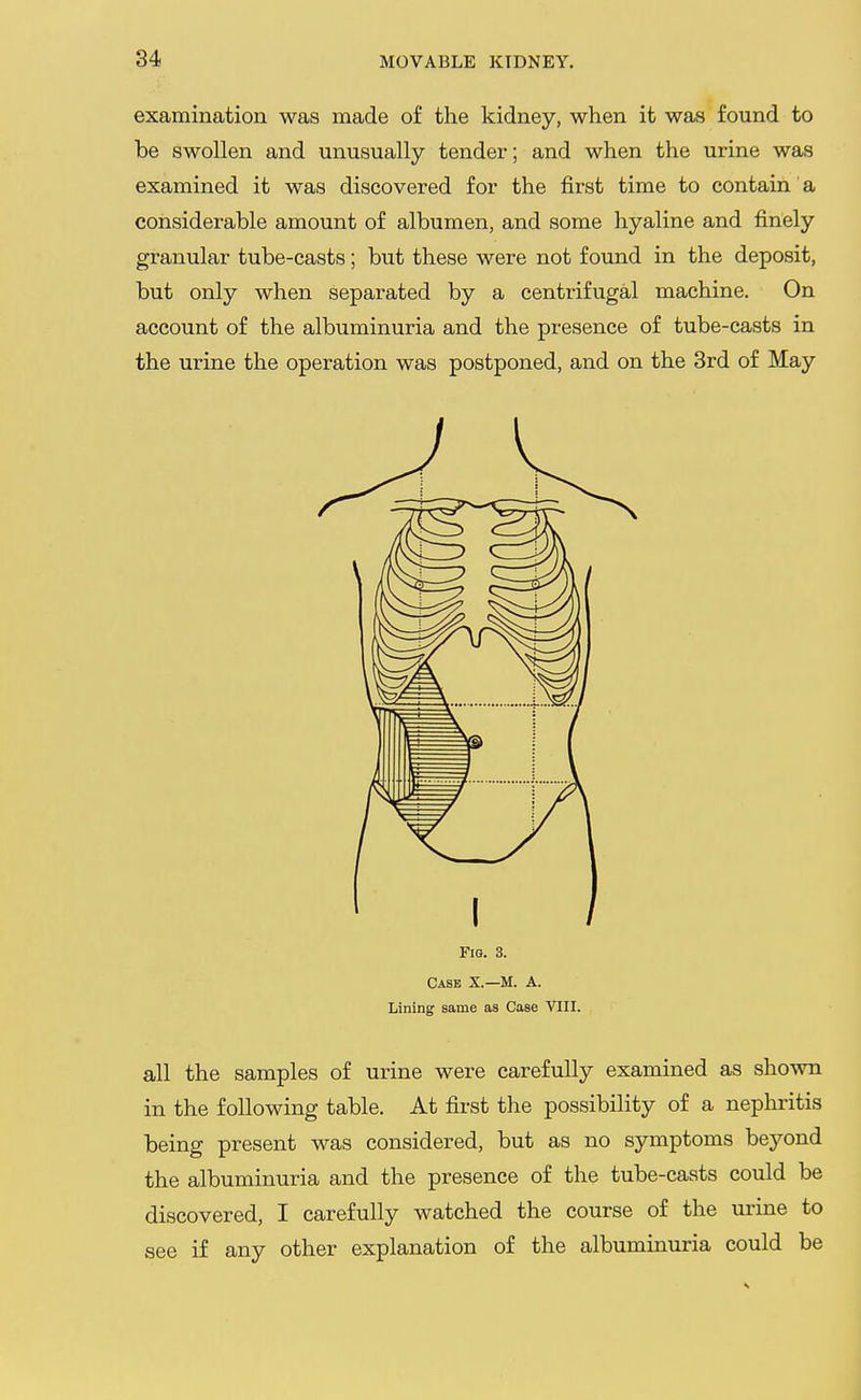 examination was made of the kidney, when it was found to be swollen and unusually tender; and when the urine was examined it was discovered for the first time to contain' a considerable amount of albumen, and some hyaline and finely granular tube-casts; but these were not found in the deposit, but only when separated by a centrifugal machine. On account of the albuminuria and the presence of tube-casts in the urine the operation was postponed, and on the 3rd of May Fig. 3. Case X.—M. A. Lining same as Case VIH. all the samples of urine were carefully examined as shown in the following table. At first the possibility of a nepliritis being present was considered, but as no symptoms bej'-ond the albuminuria and the presence of the tube-casts could be discovered, I carefully watched the course of the urine to see if any other explanation of the albuminuria could be