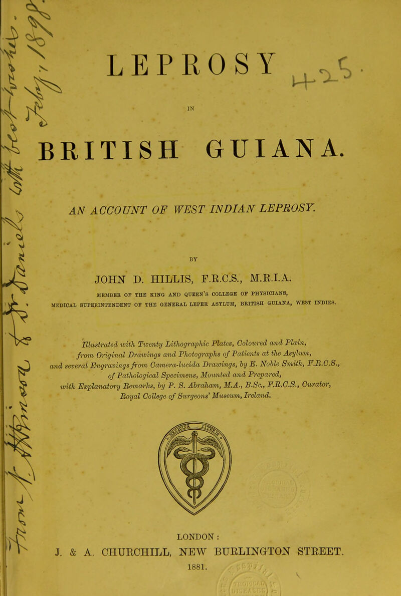 LEPROSY . IN ^ BRITISH GUIANA. AN ACCOUNT OF WEST INDIAN LEPROSY. 4^ BY JOHN D. HILLIS, F.E.C.S., M.E.I.A. MEMBEE OP THE KING AND QTJEBN'S COLLEGE OP PHYSICIANS, MEDICAL aUPERINTENDBNT OF THE GENEBAL LEPEB ASYLUM, BRITISH GUIANA, WEST INDIES. Illustrated luith Twenty Litliogra/pMc Plates, Colowed and Flam, from Original Drawings and Photog^-apTis of Patients at the Asylum, and s&ve)-al Engravings from Oamera-hhcida Drawings, ly E. Noble Smith, F.B.C.8., of Pathological Specimens, Moimted and Prepared, with Explanatory Bema/rhs, by P. S. Abraham, M.A., B.Sc, F.B.O.S., Gwrator, Boyal College of Swgeons' Musevm, Ireland. \ LONDON: & A. CHURCHILL, NEW BURLINGTON STREET. 1881.