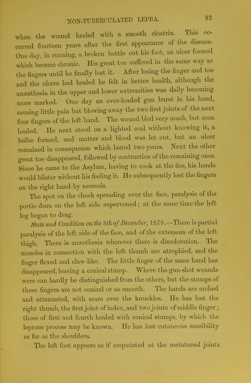 v^^hen the wound healed with a smooth cicatrix. This oc- curred fourteen years after the first appearance of the disease. One day, in running, a broken bottle cut his foot, an ulcer formed which became chronic. His great toe suffered in the same way as the fino-ers untU he finally lost it. After losing the finger and toe and the vilcers had healed he felt in better health, although the anaesthesia in the upper and lower extremities was daily becoming more marked. One day an over-loaded gun burst in his hand, causing little pain but blowing away the two first joints of the next four fingers of the left hand. The wound bled very much, but soon healed. He next stood on a lighted coal without knowing it, a bullse formed, and matter and blood was let out, but an ulcer remained in consequence wHch lasted two years. Next the other gToat toe disappeared, followed by contraction of the remaining ones. Since he came to the Asylum, having to cook at the fire, his hands would blister without his feelmg it. He sabsequently lost the fingers on the right hand by necrosis. The spot on the cheek spreading over the face, paralysis of the portio dura on the left side supervened; at the same time the left leg began to drag. State and Condition on the Sth of December, 1578.—There is partial paralysis of the left side of the face, and of the extensors of the left thigh. There is anaesthesia wherever there is discoloration. The muscles in connection with the left thumb are atrophied, and the finger flexed and claw-like. The little finger of the same hand has disappeared, leaving a conical stump. Where the gun-shot wounds were can hardly be distinguished from the others, but the stumps of these fingers are not conical or as smooth. The hands are arched and attenuated, with scars over the knuckles. He has lost the right thumb, the first joint of index, and two joints of middle finger; those of first and fourth healed with conical stumps, by whicli the leprous process may be known. He has lost cutaneous sensibility as far as the shoulders. The left foot appears as if amputated at the metatarsal joints