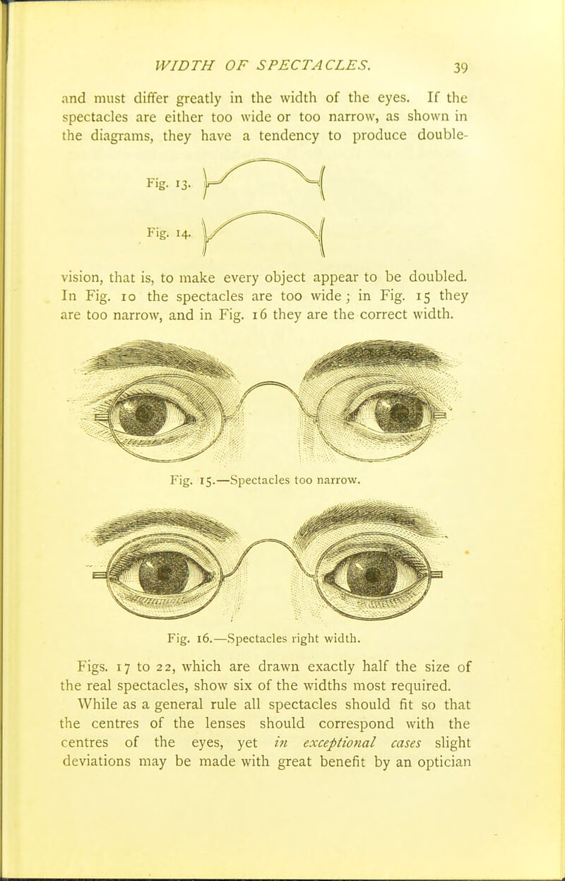 and must differ greatly in the width of the eyes. If the spectacles are either too wide or too narrow, as shown in the diagrams, they have a tendency to produce double- Fig. 13- Fig. 14. vision, that is, to make every object appear to be doubled. In Fig. 10 the spectacles are too wide; in Fig. 15 they are too narrow, and in Fig. 16 they are the correct width. Fig. 15.—Spectacles too narrow. Fig. 16.—Spectacles right width. Figs. 17 to 22, which are drawn exactly half the size of the real spectacles, show six of the widths most required. While as a general rule all spectacles should fit so that the centres of the lenses should correspond with the centres of the eyes, yet hi exceptional cases slight deviations may be made with great benefit by an optician